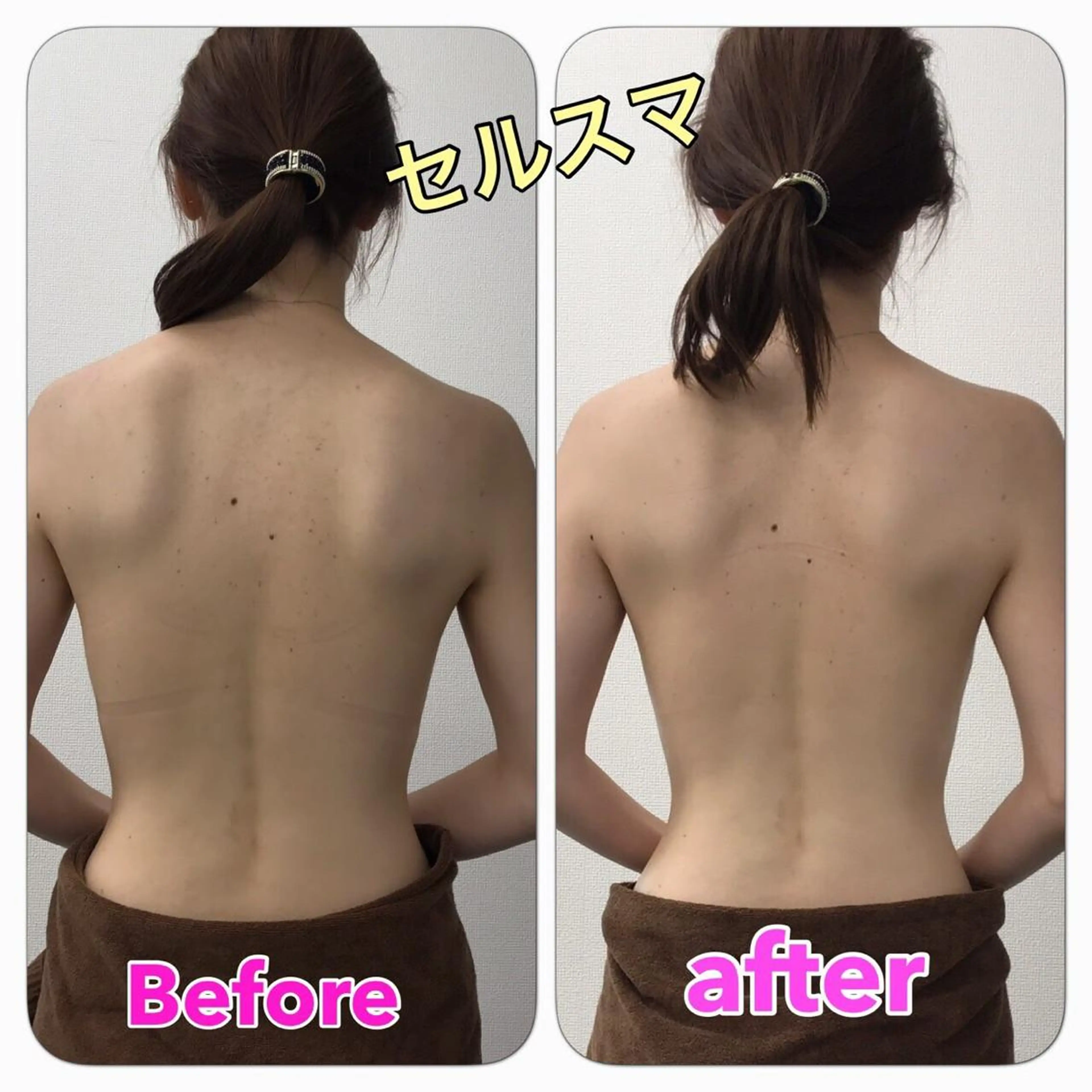 〈初回限定〉セルライトスマッシュの写真