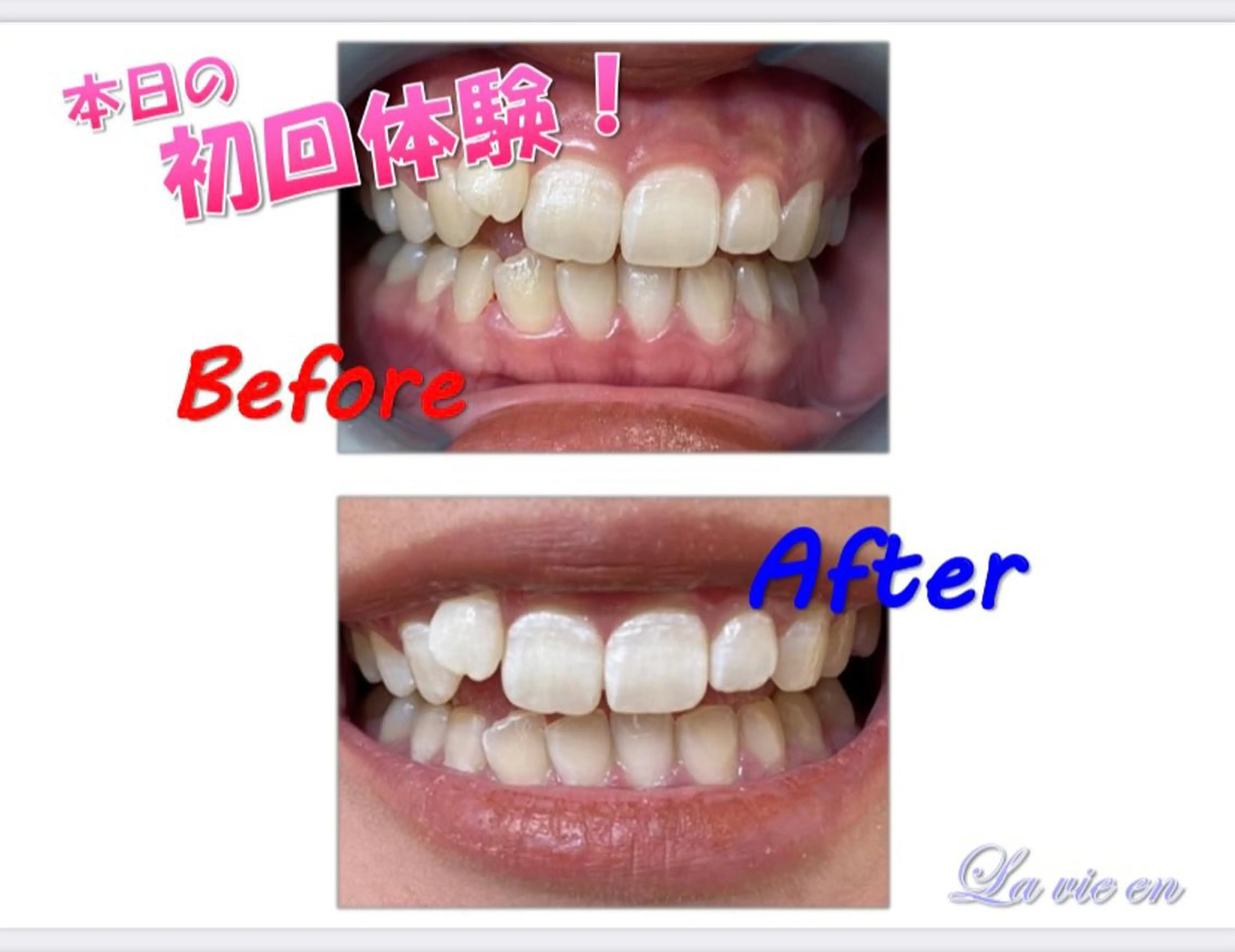 その他 セルフホワイトニングサロン　ラヴィアン所属・ホワイトニングサロン La vie enのその他イメージ