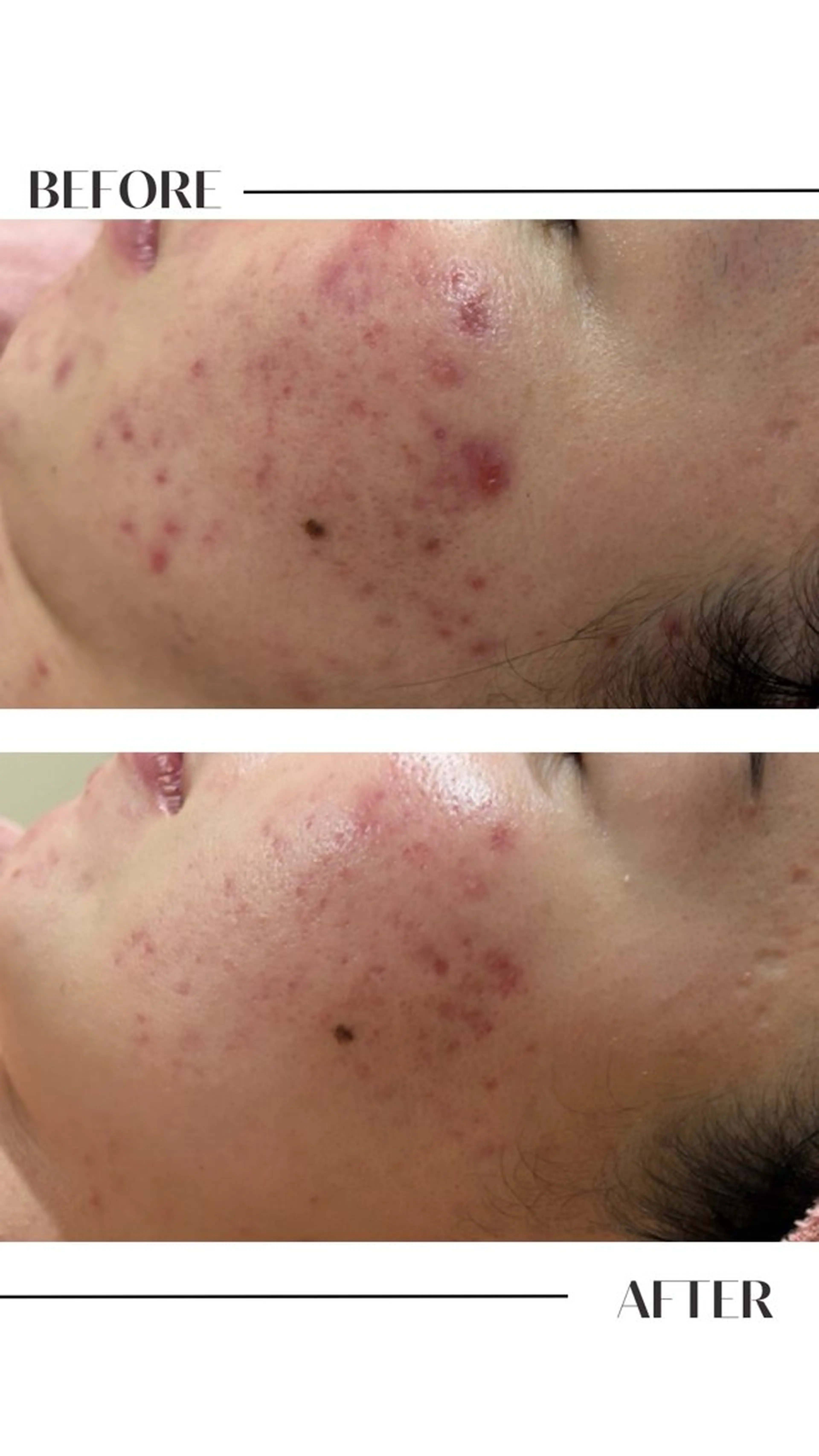 フェイシャル/脱毛 ジョアアンジェ　田中のエステ・リラクイメージ