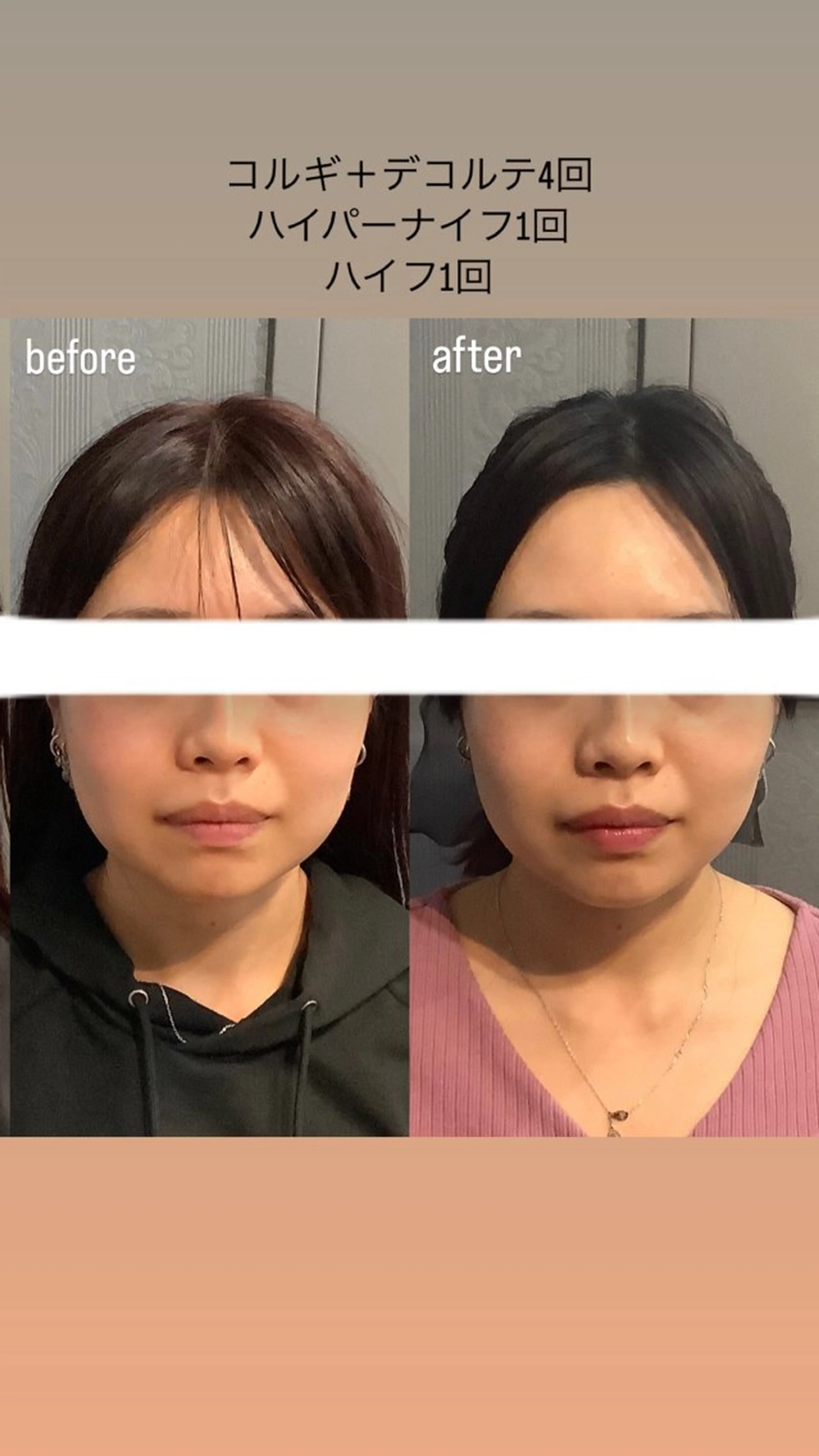 エステ リラク エステサロンino.colore'所属・小顔サロン ino.coloreのエステ・リラクイメージ