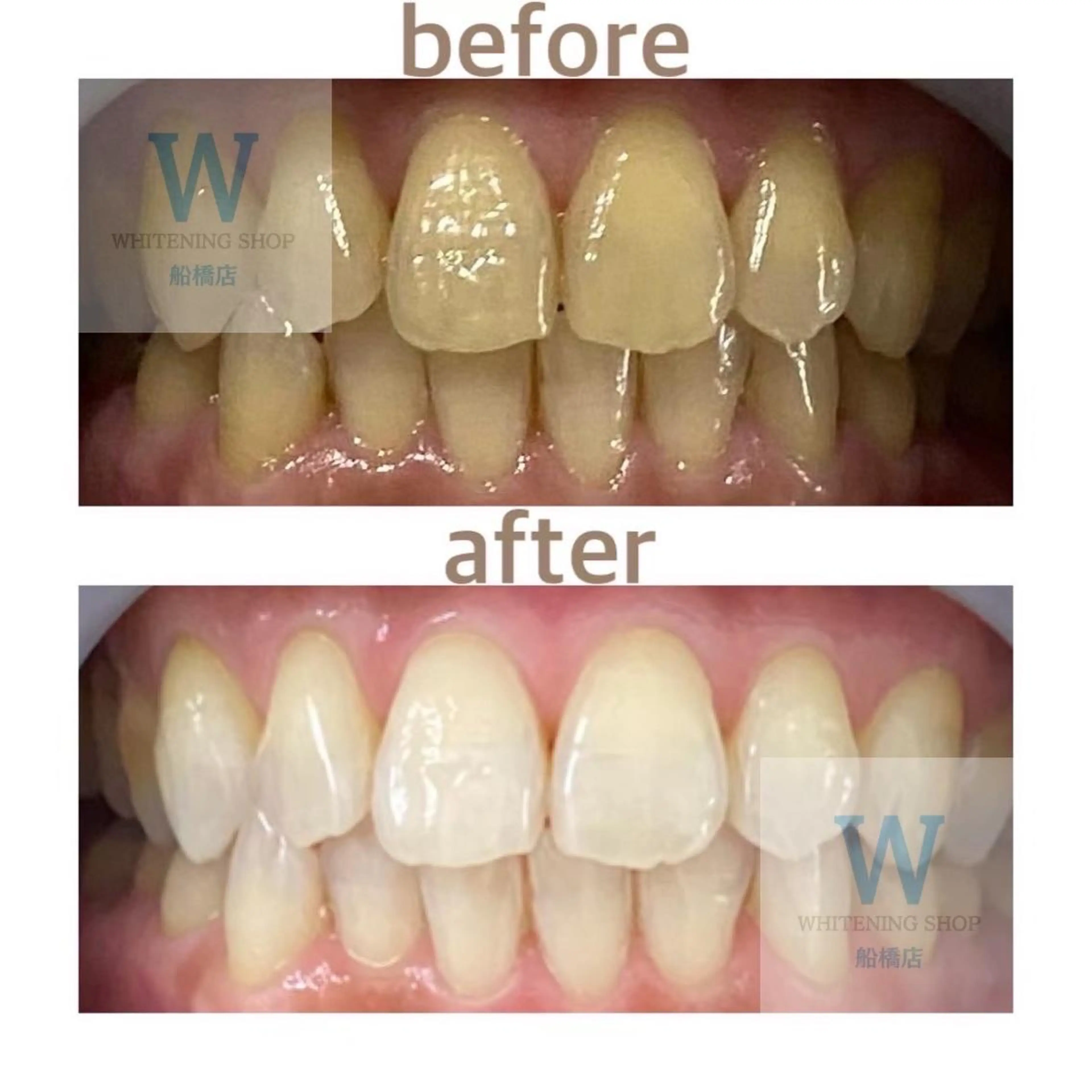 エステ リラク ホワイトニング ショップ船橋2号店のエステ・リラクイメージ