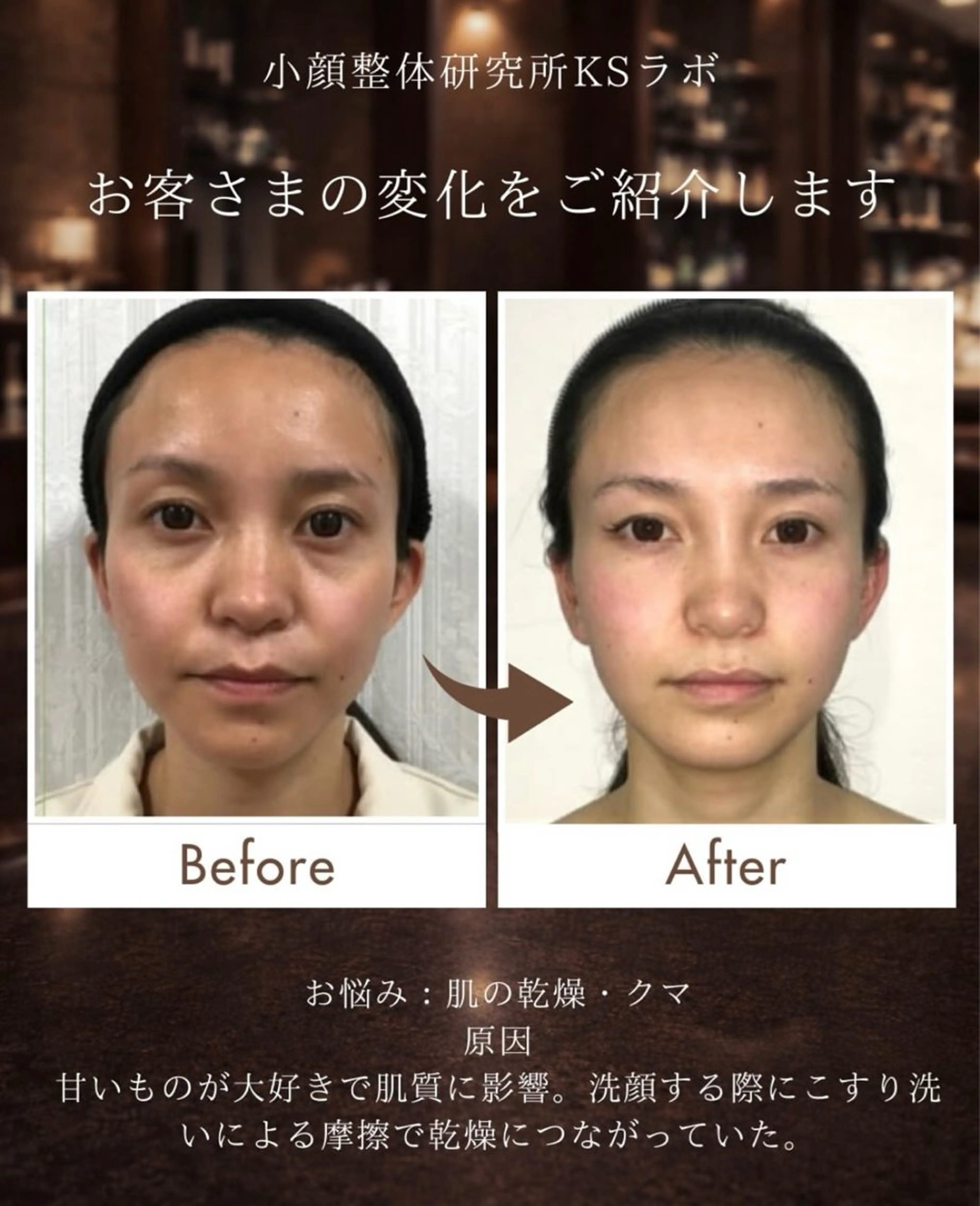 KSラボ自由が丘店所属・小顔整体研究所 KSラボ自由が丘店のエステ・リラクイメージ