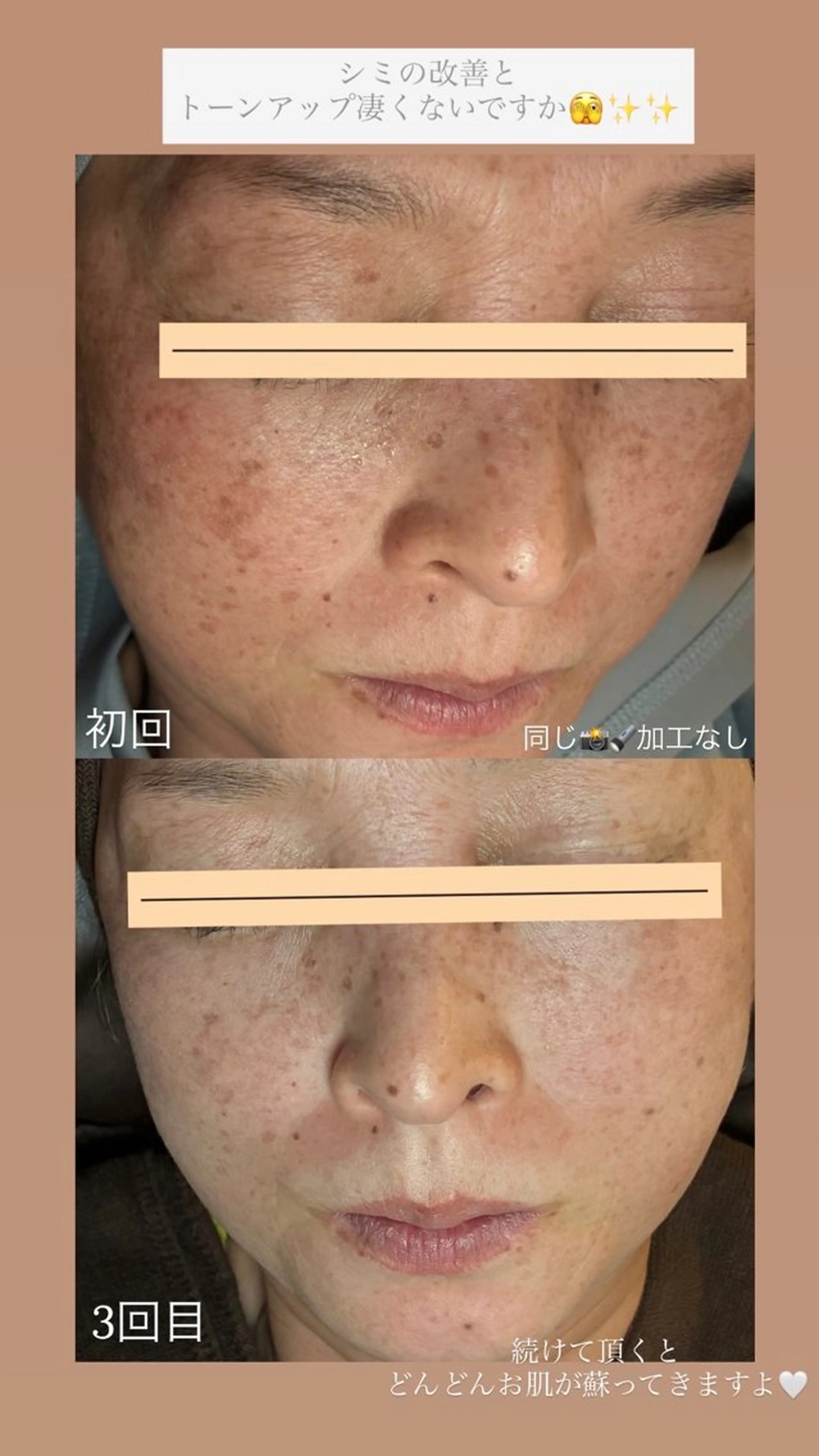 chouchou【シュシュ】所属・トータルボディケア chouchouのエステ・リラクイメージ