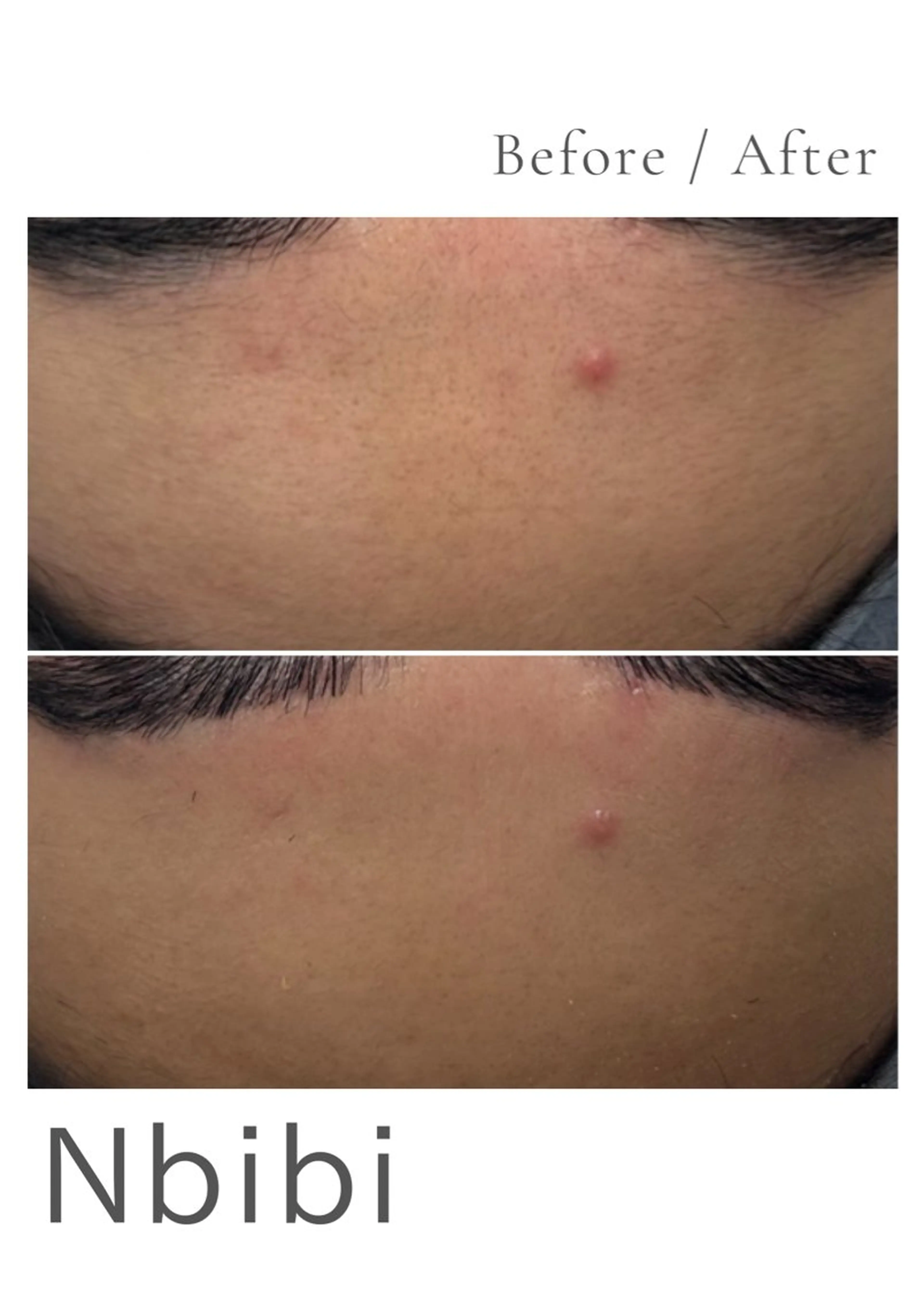 エステ 韓国🇰🇷価格 サロン_Nbibiのエステ・リラクイメージ