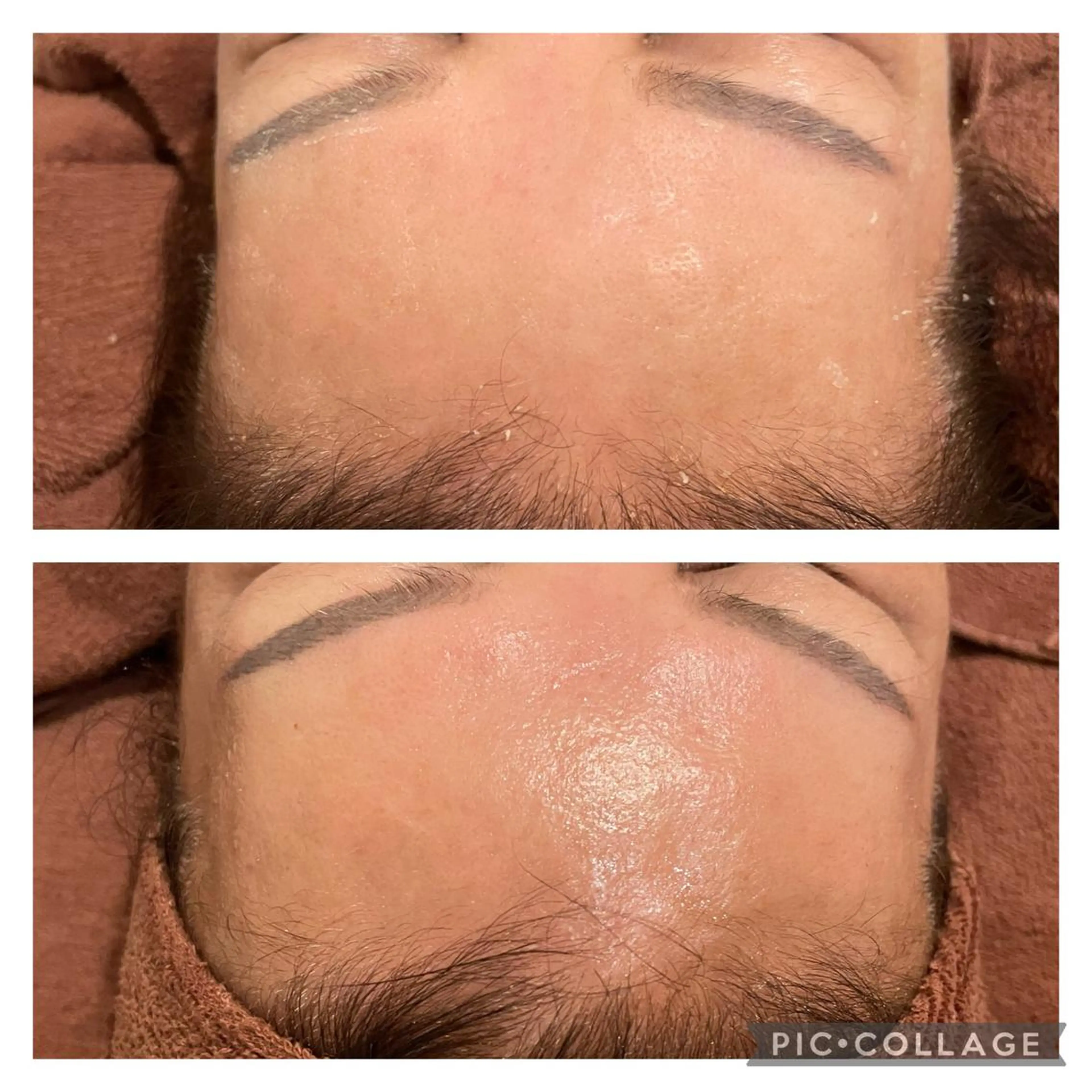 セミロング カラー パーマ ヘアアレンジ メンズ キッズ ネイル マツエク・マツパ アイブロウ ニキビ特化型エステ 🍓最短で肌質改善のその他イメージ