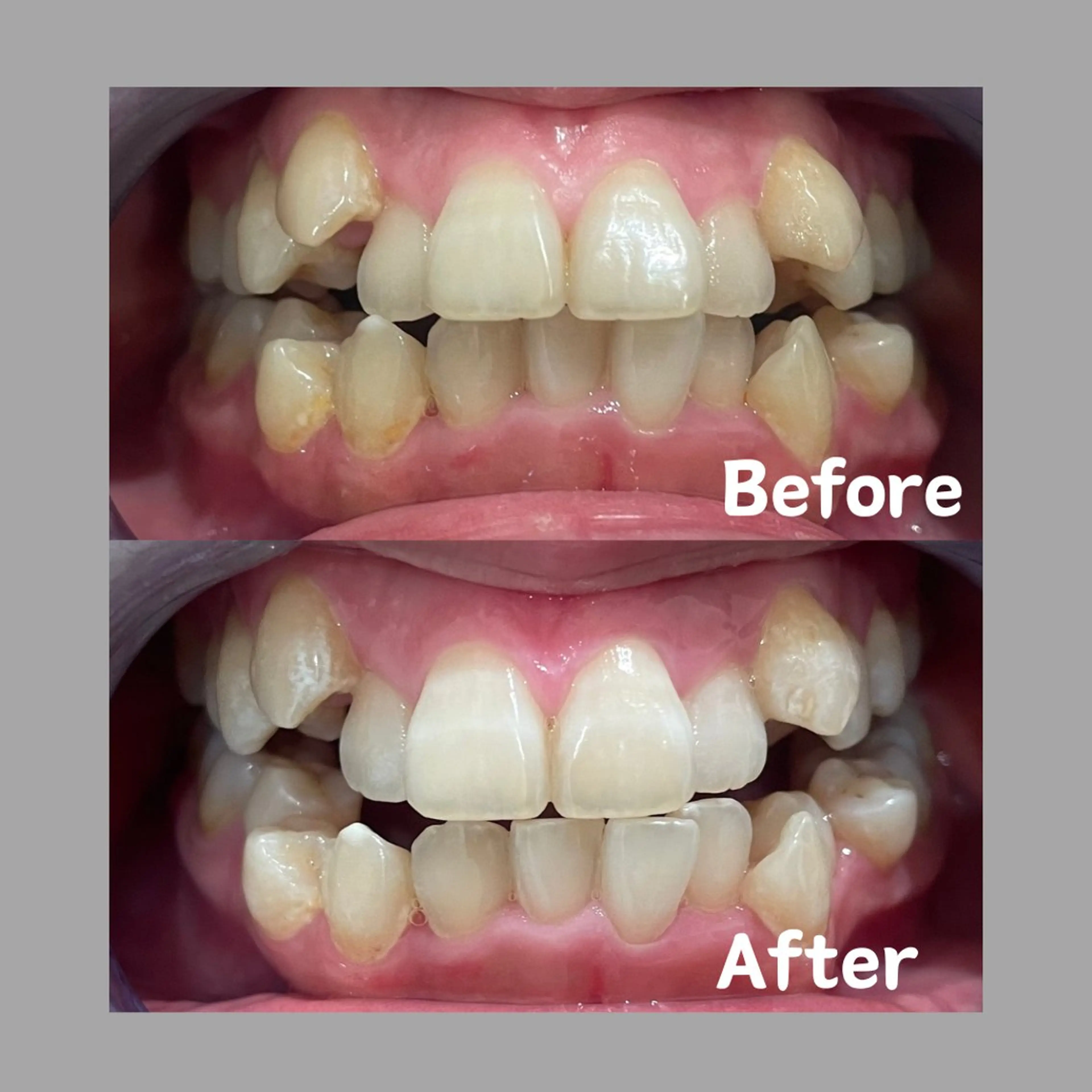 Kaula所属・Kaula ホワイトニング耳ツボのその他イメージ