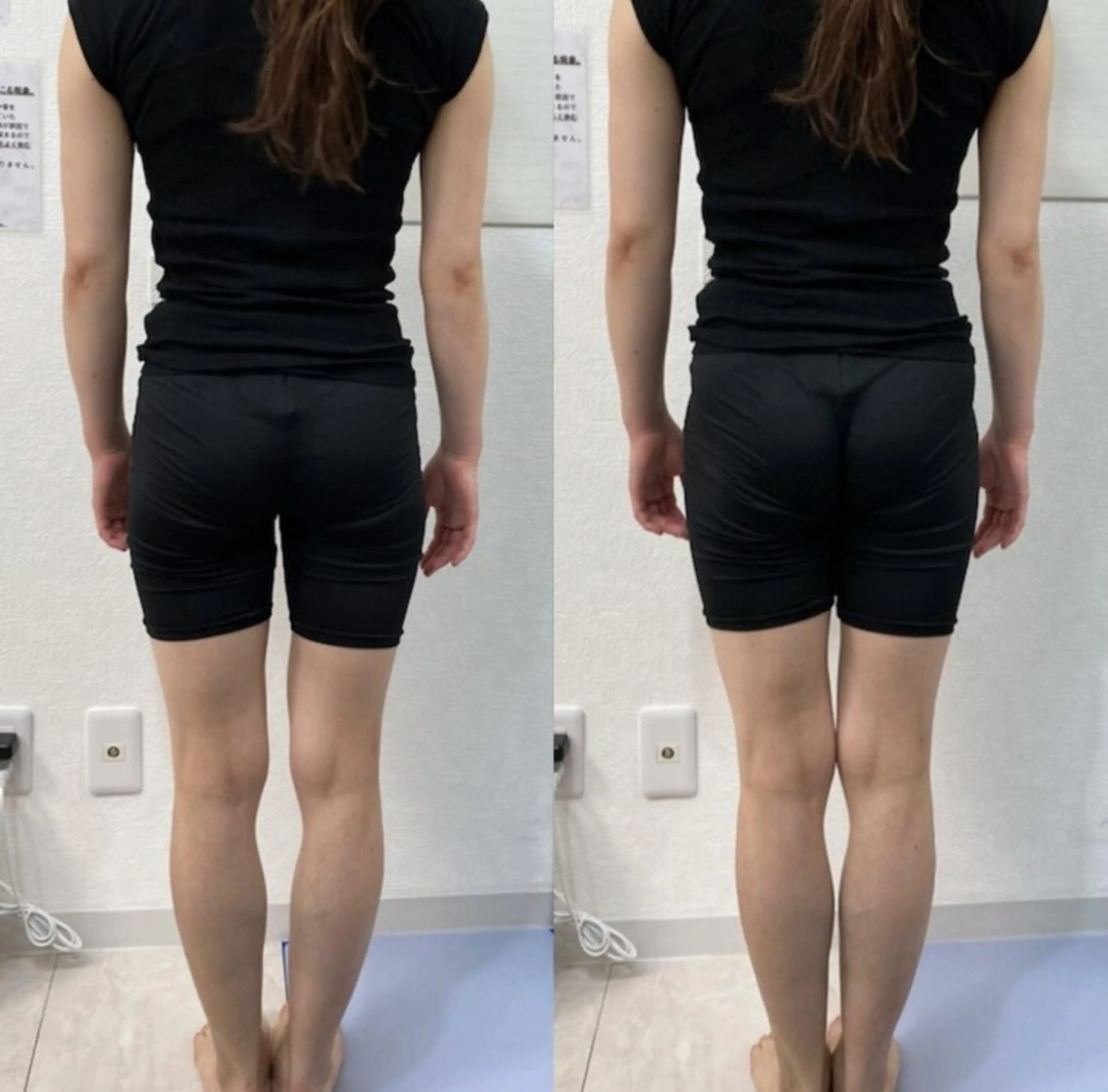 ✨学割U24✨脱毛/ネイル/エステ後も‼️小顔も美脚も美姿勢も叶う‼️プロの【小顔矯正＋骨盤矯正＋頭蓋骨矯正】 120分の写真