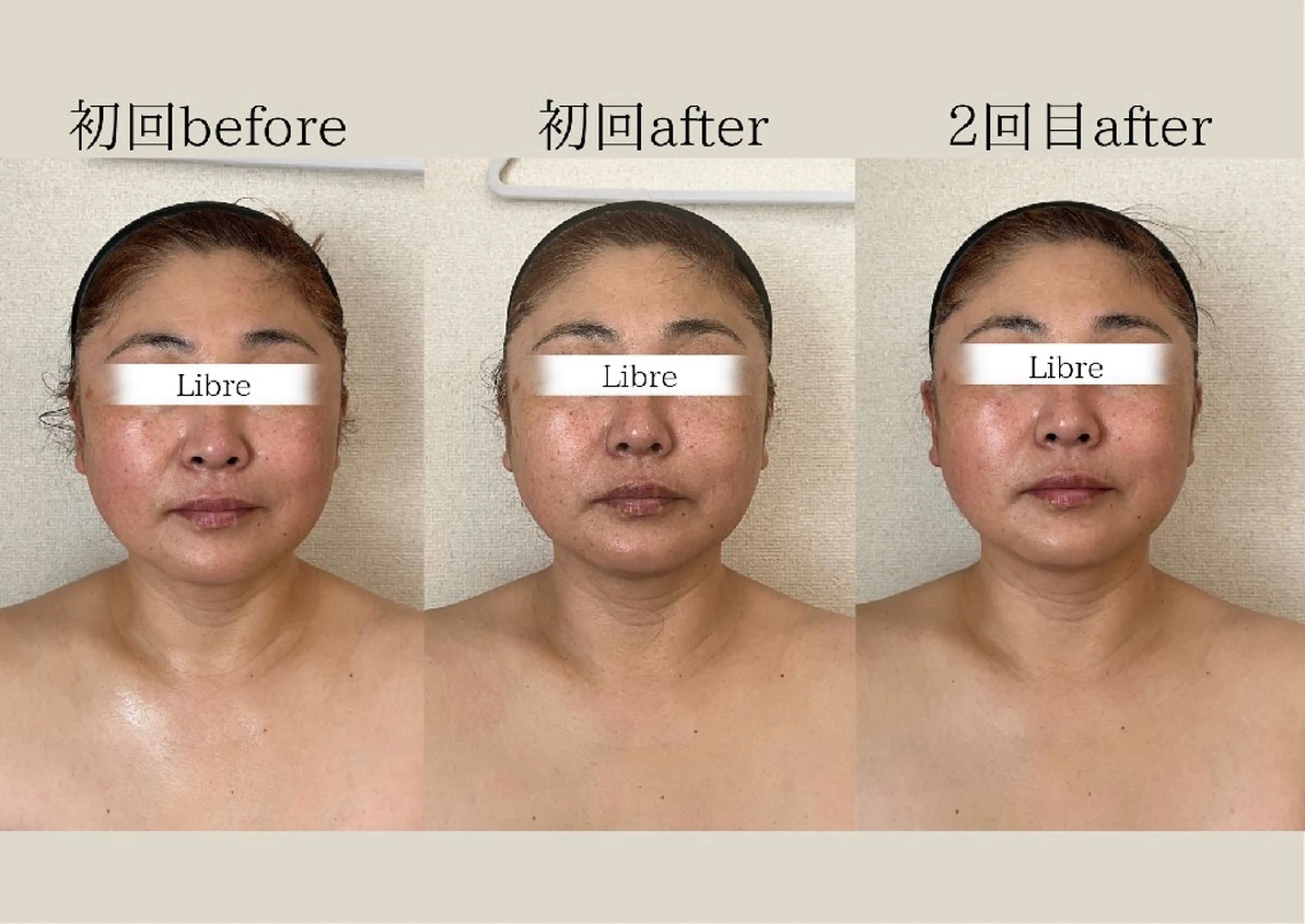 小顔コルギ&肌質改善 の専門店LIBREのエステ・リラクイメージ