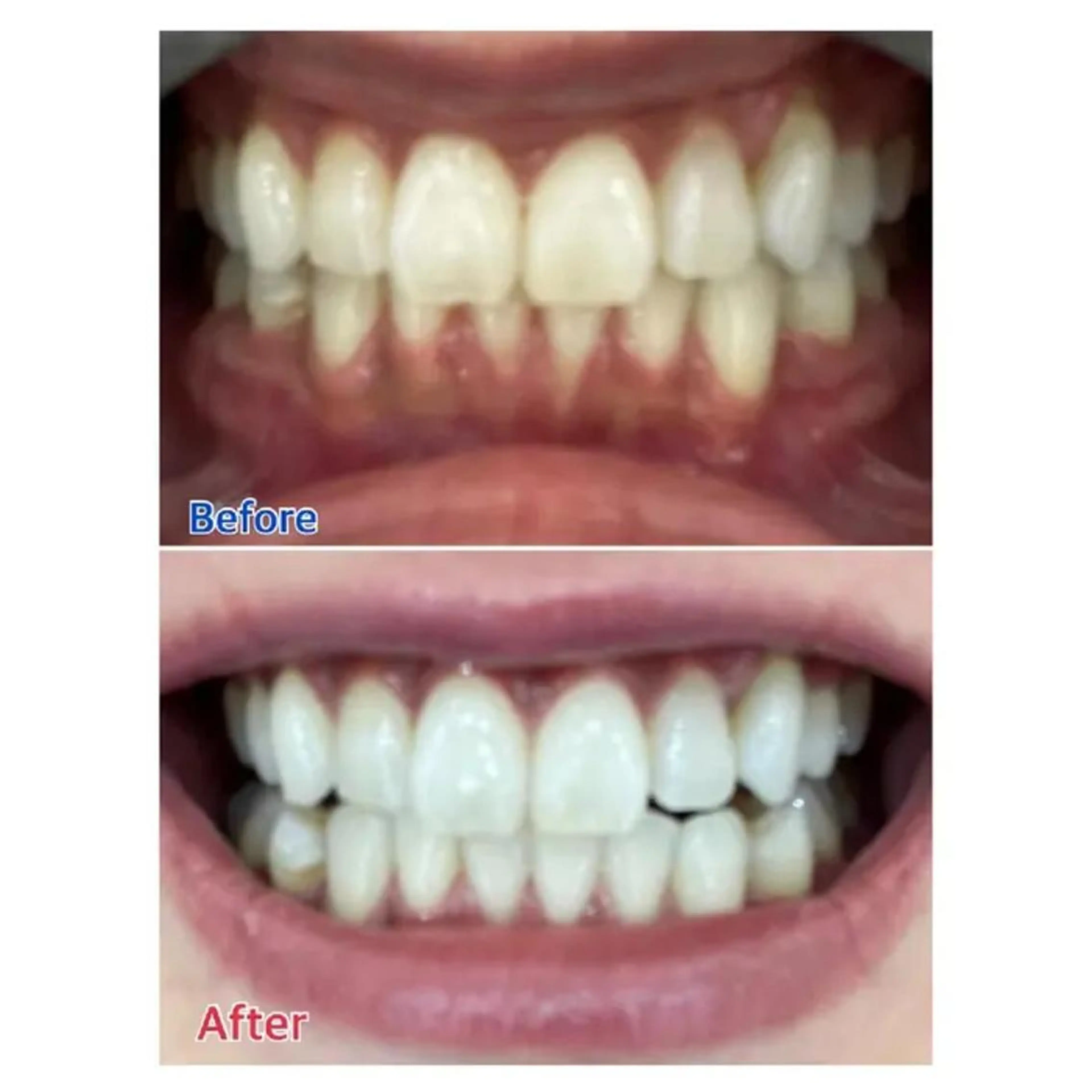 M渋谷店所属・Ｍ渋谷 ホワイトニングのその他イメージ