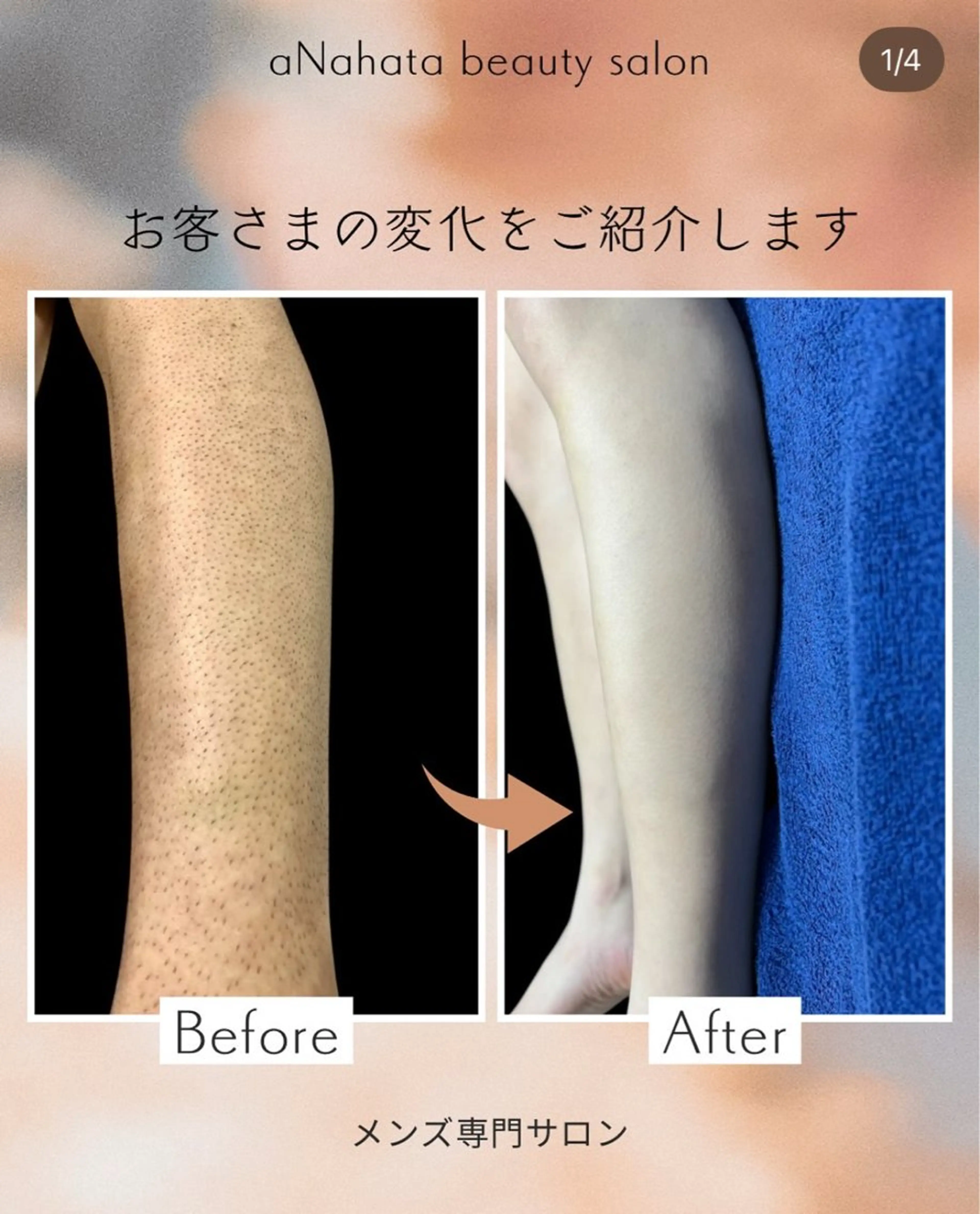 メンズ aNahata beauty salon所属・田中 菜月のエステ・リラクイメージ