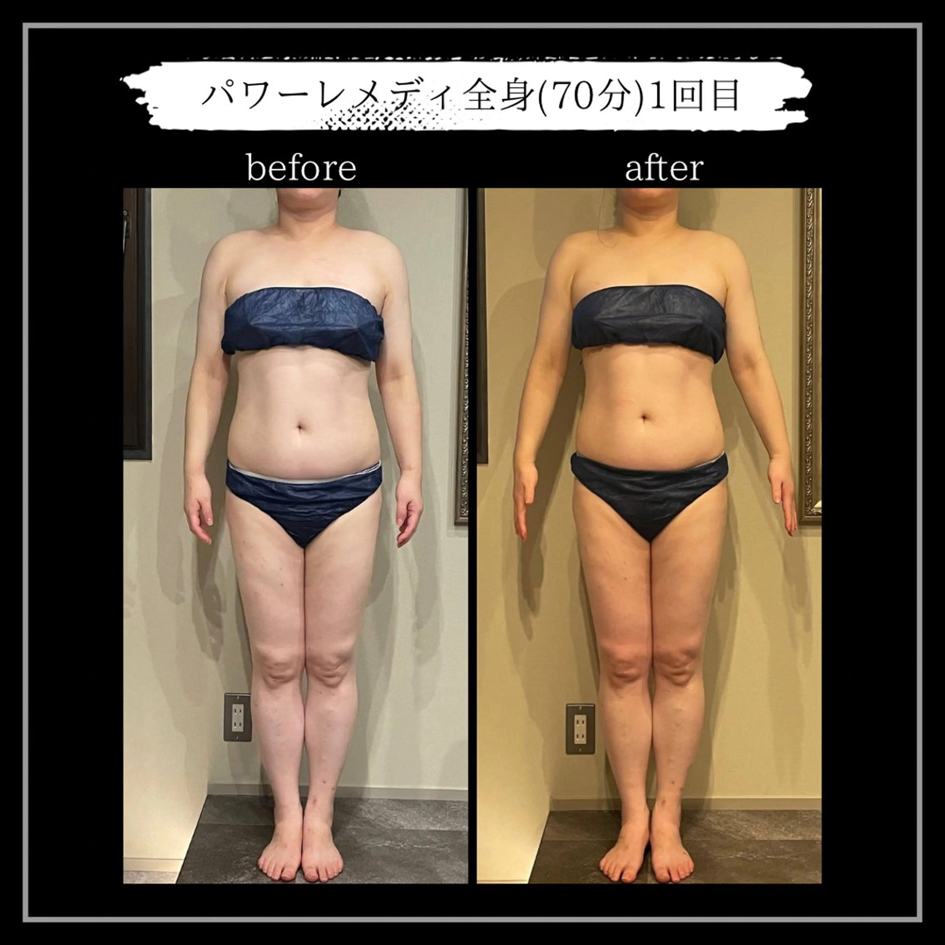 オフ:オン所属・オフ:オン 全身筋膜マッサージのエステ・リラクイメージ