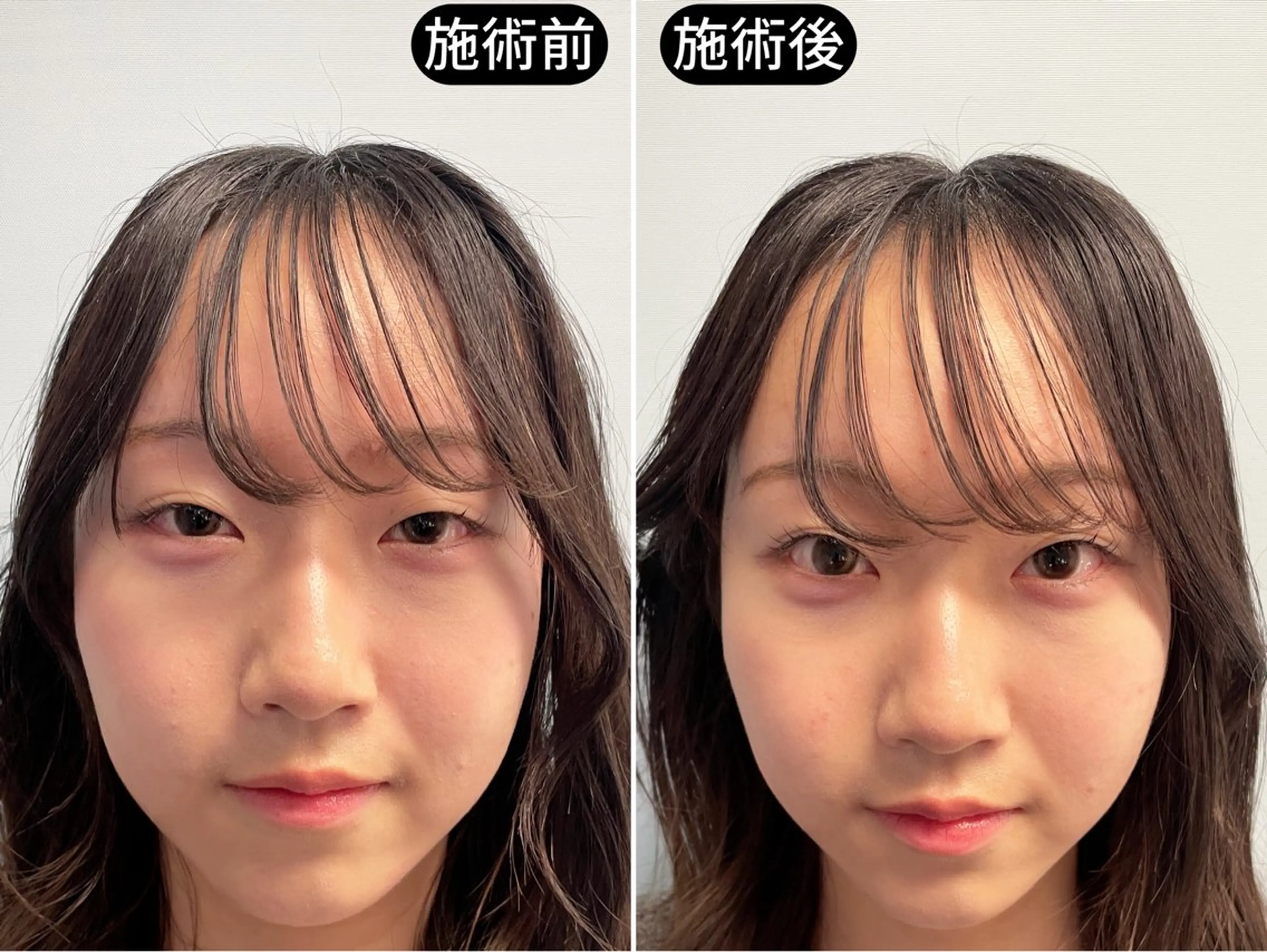 エステ リラク 渋谷 小顔美容鍼 専門サロン YZのエステ・リラクイメージ