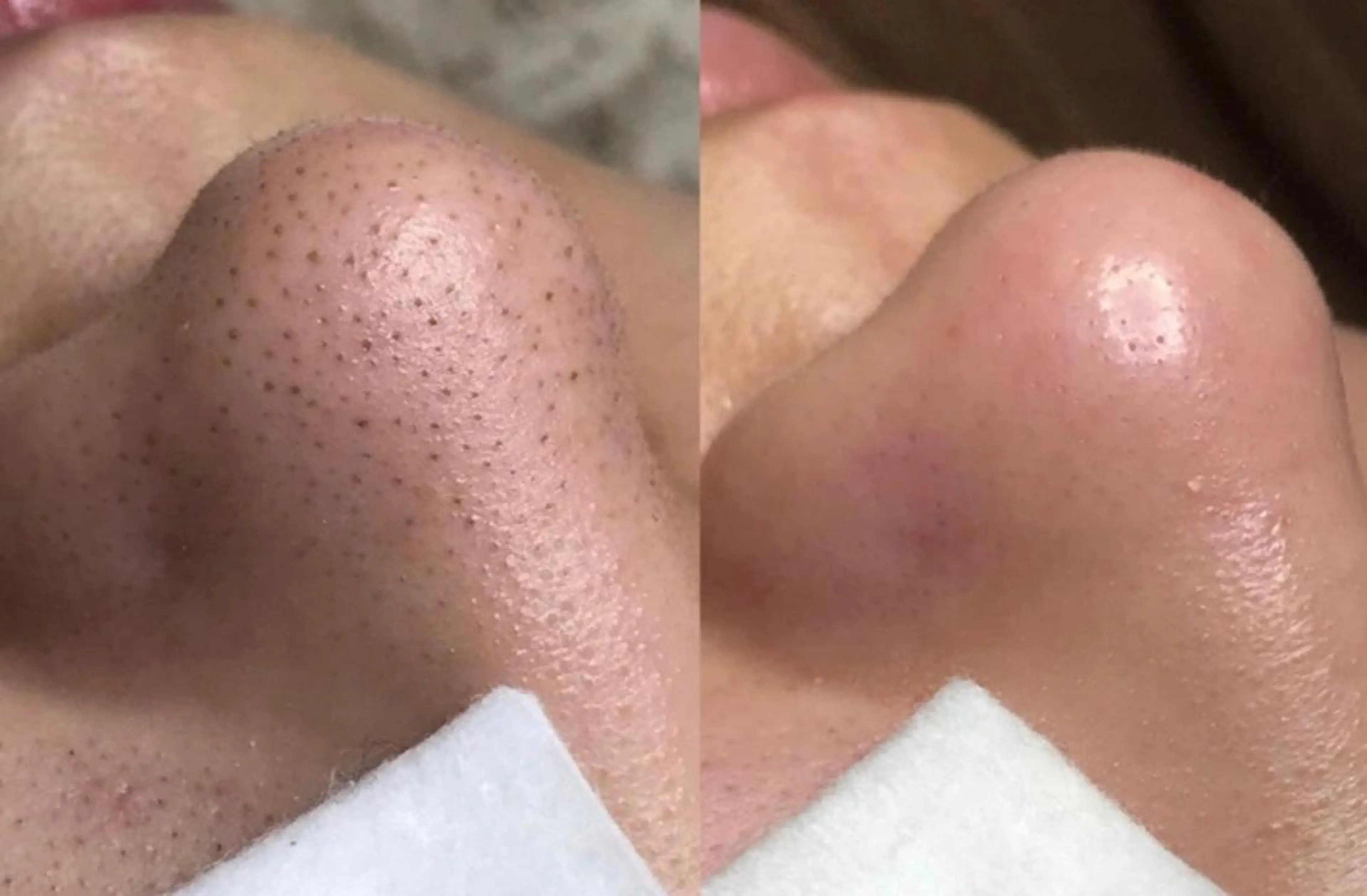 メンズ アクシア ビューティー サロン所属・究極のアンチエイ ジングサロンのエステ・リラクイメージ