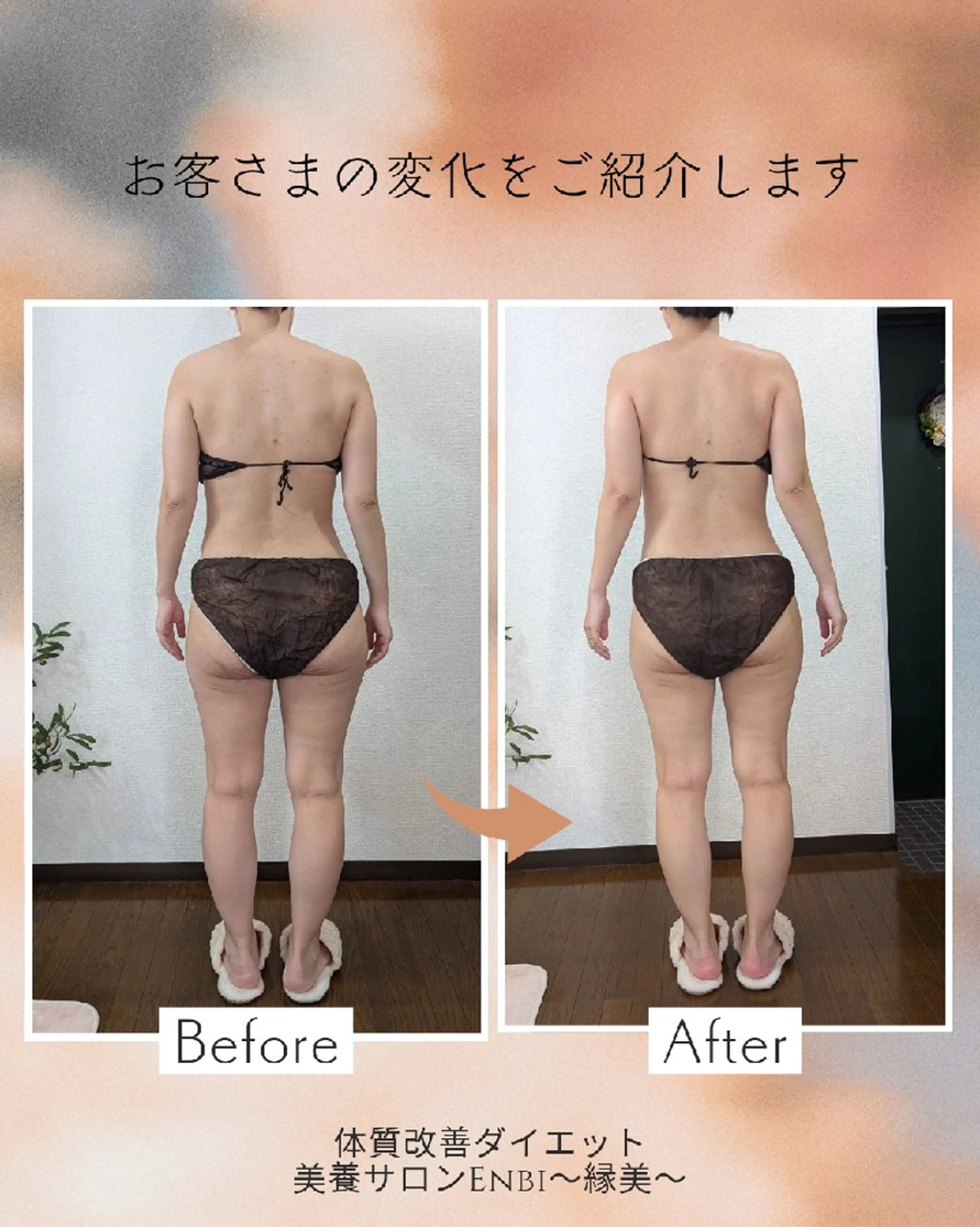 【痩身▪️体質改善ダイエット】美養サロンEnbi～縁美～所属・美養サロンEnbi ～縁美～のエステ・リラクイメージ