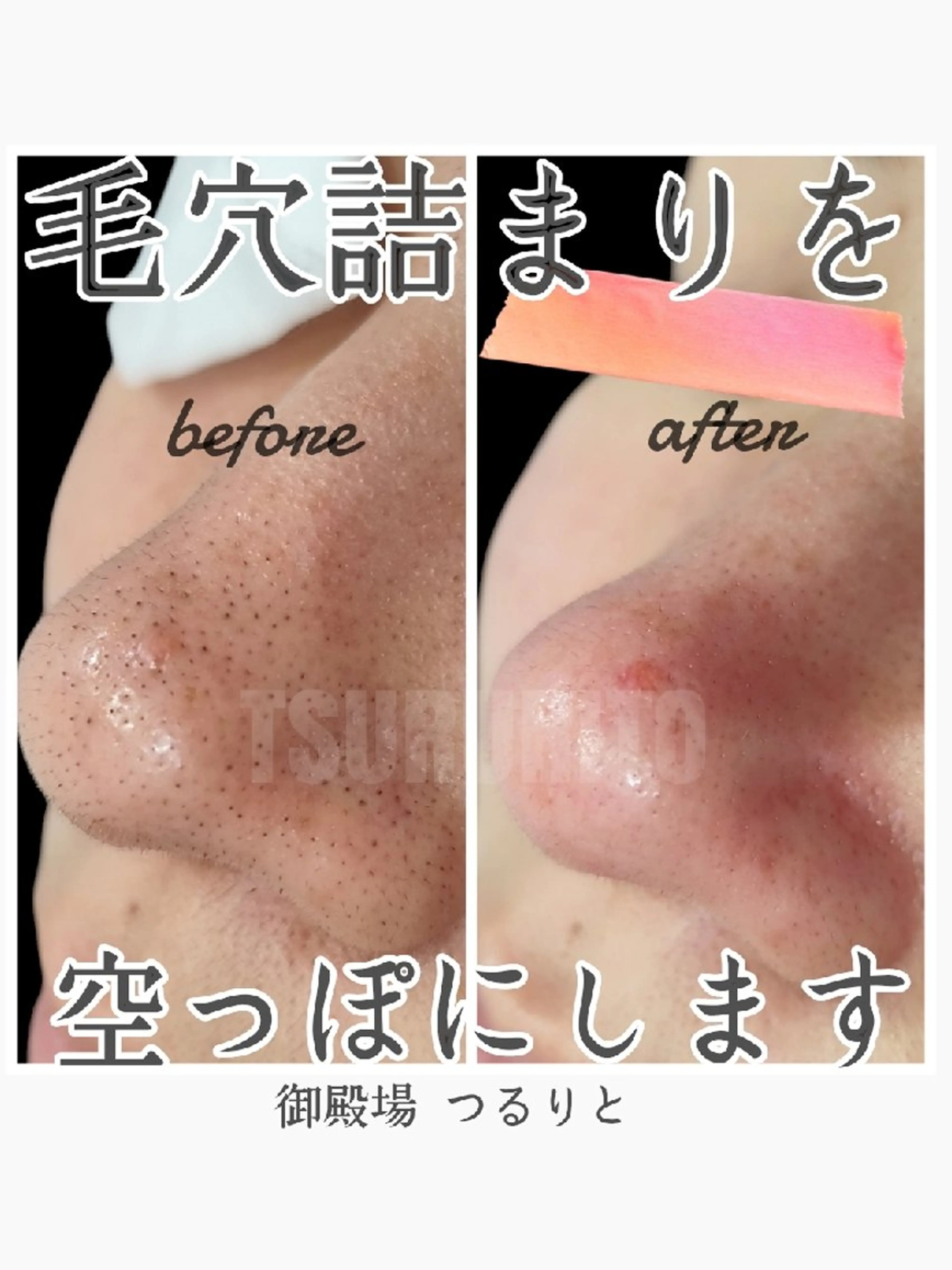 美肌脱毛サロン つるりと御殿場店所属・美肌脱毛サロン つるりとのその他イメージ