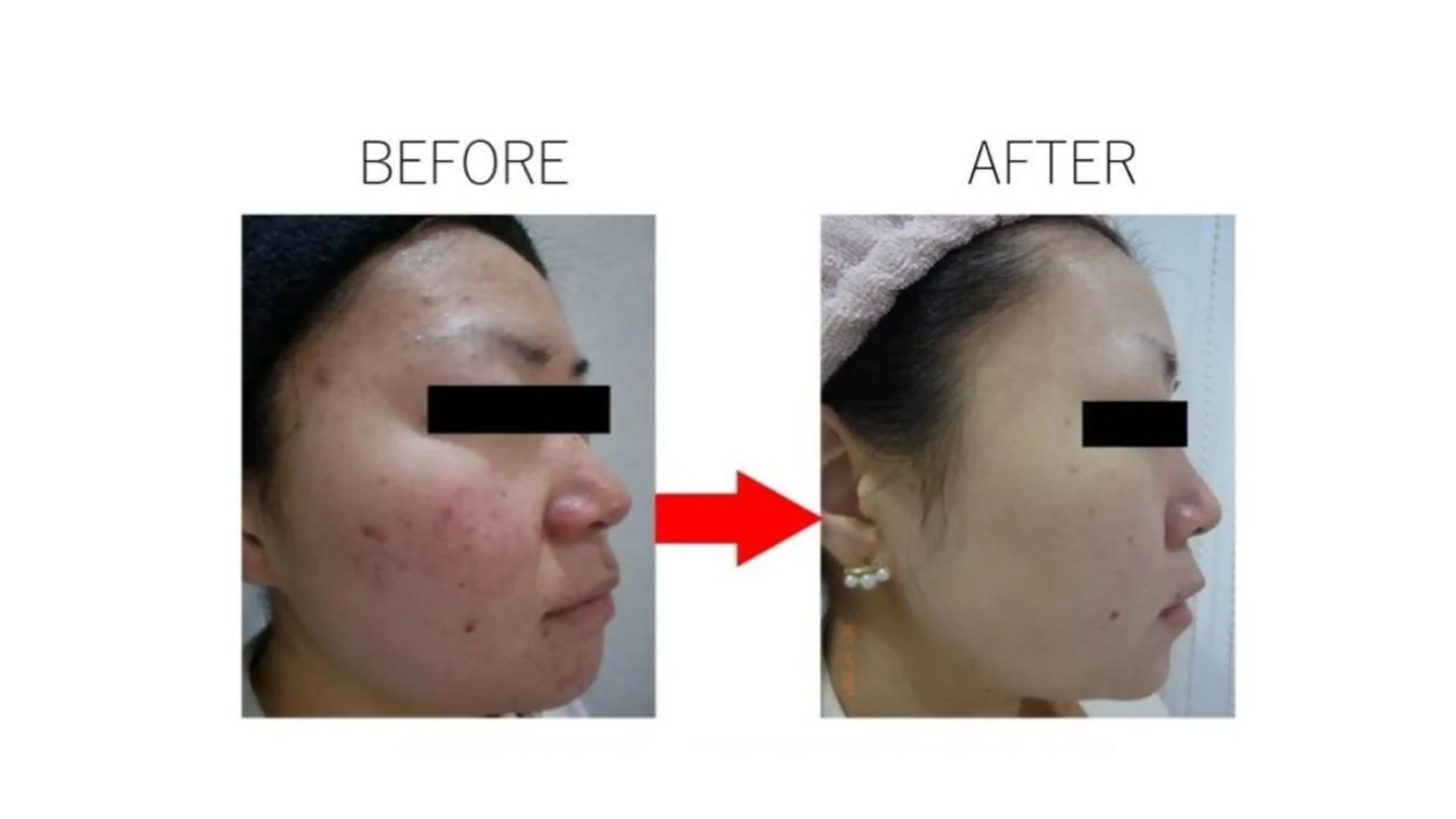 肌質改善専門サロン ／FSS渋谷店　松本のエステ・リラクイメージ