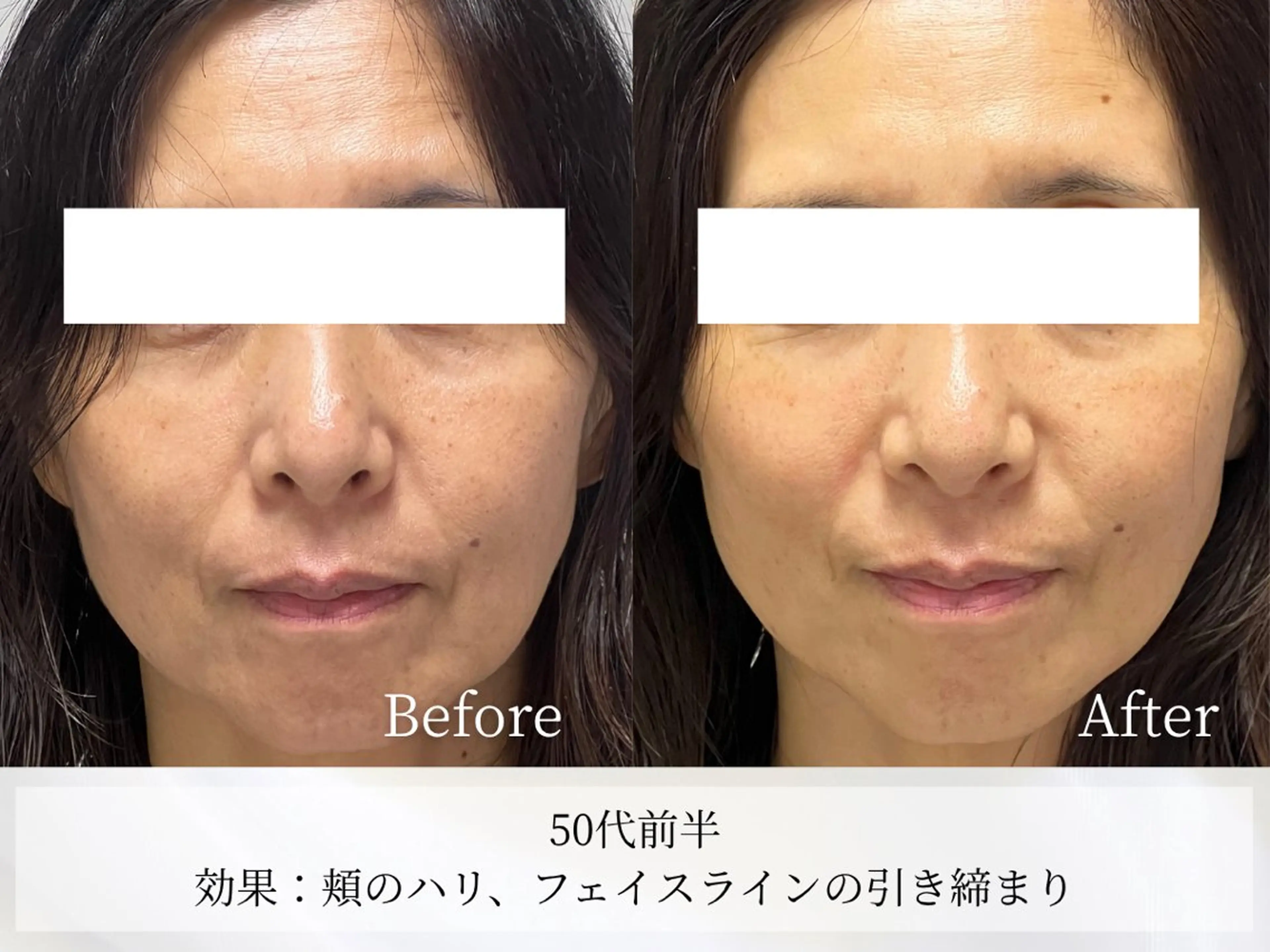 Astorie SHIORIのエステ・リラクイメージ