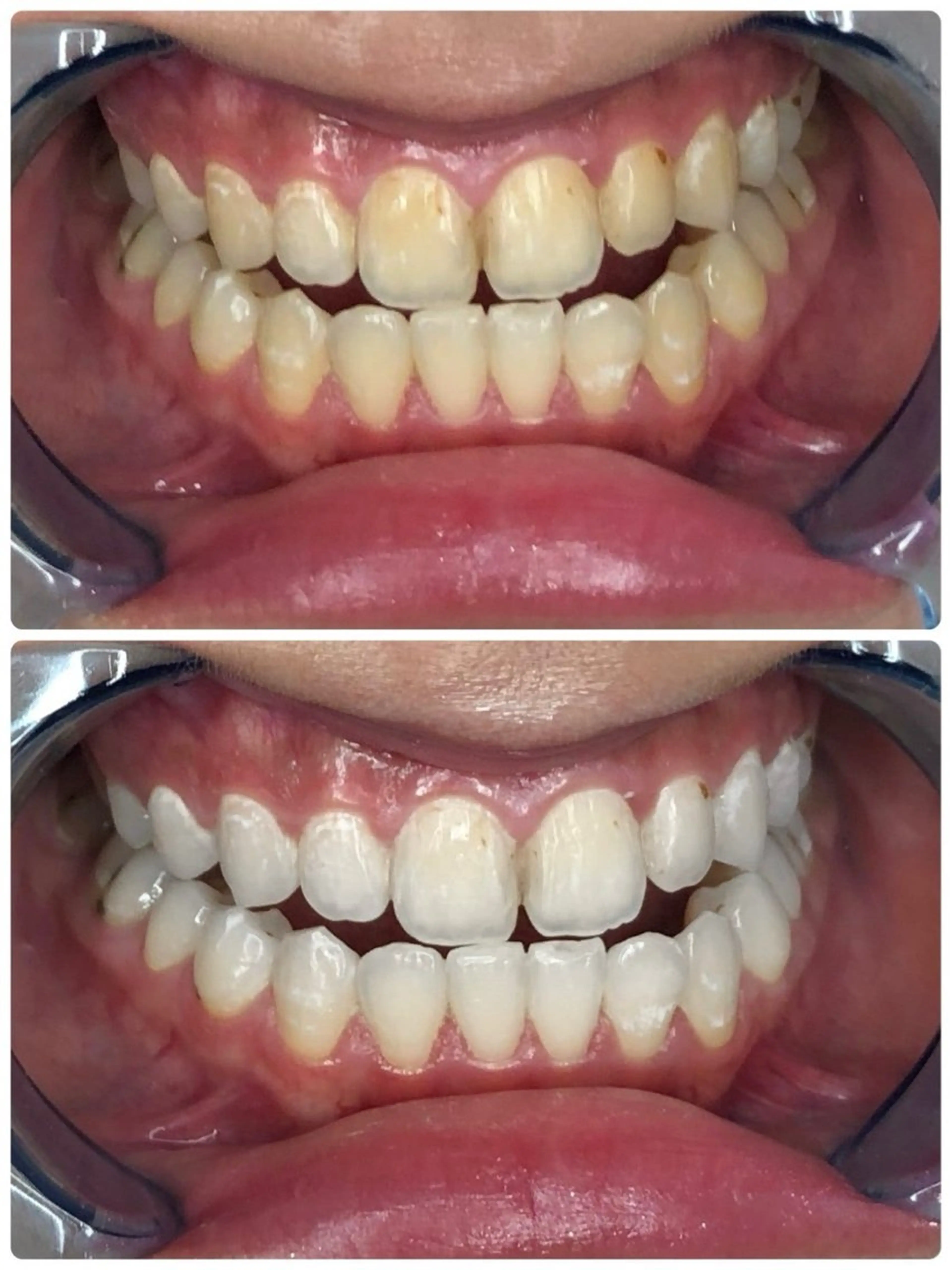 その他 Whitening Beauty 行橋店所属・Whitening Beauty 行橋店のその他イメージ