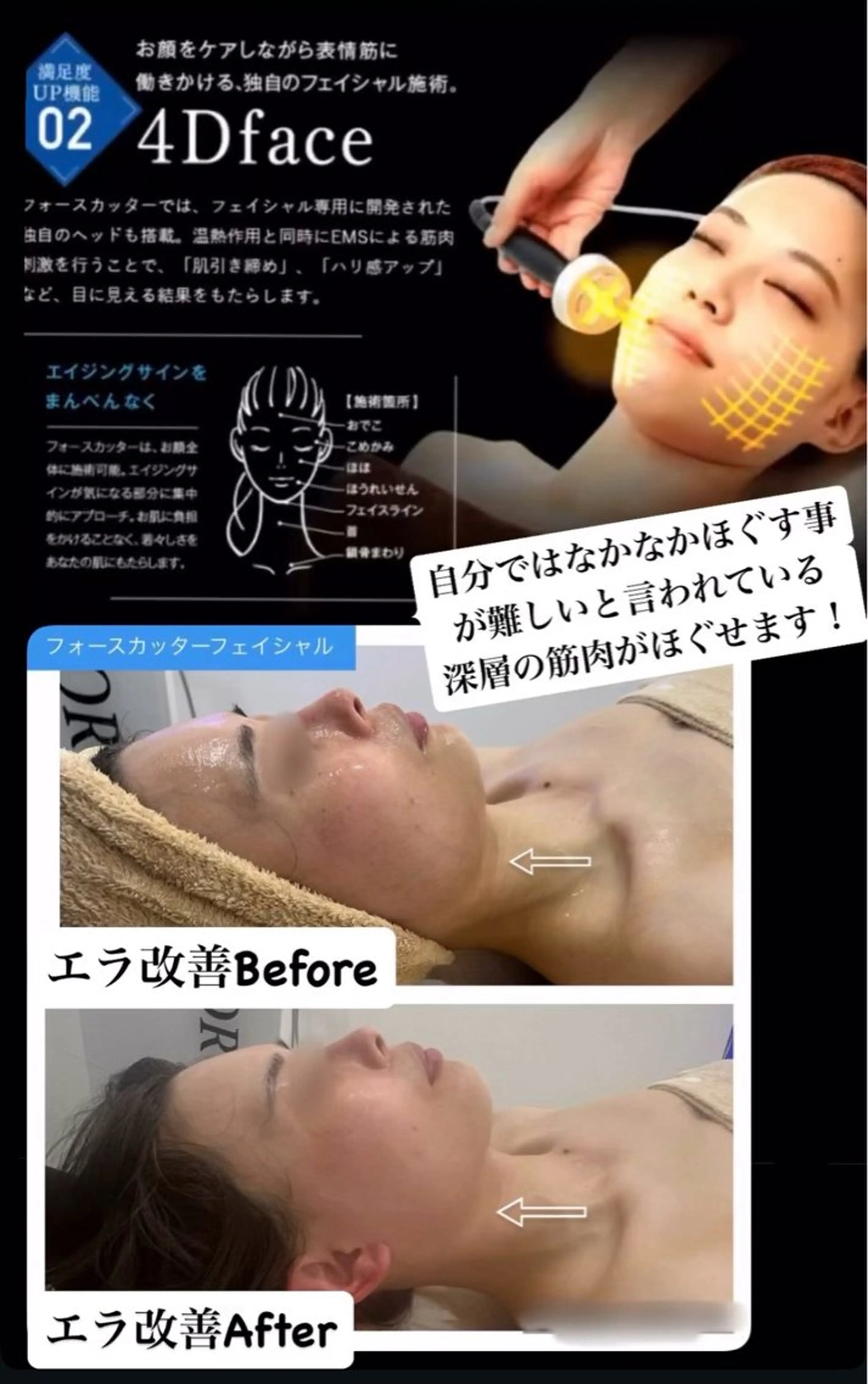 ブライダル痩身×脱毛 尼崎駅前サロンのエステ・リラクイメージ