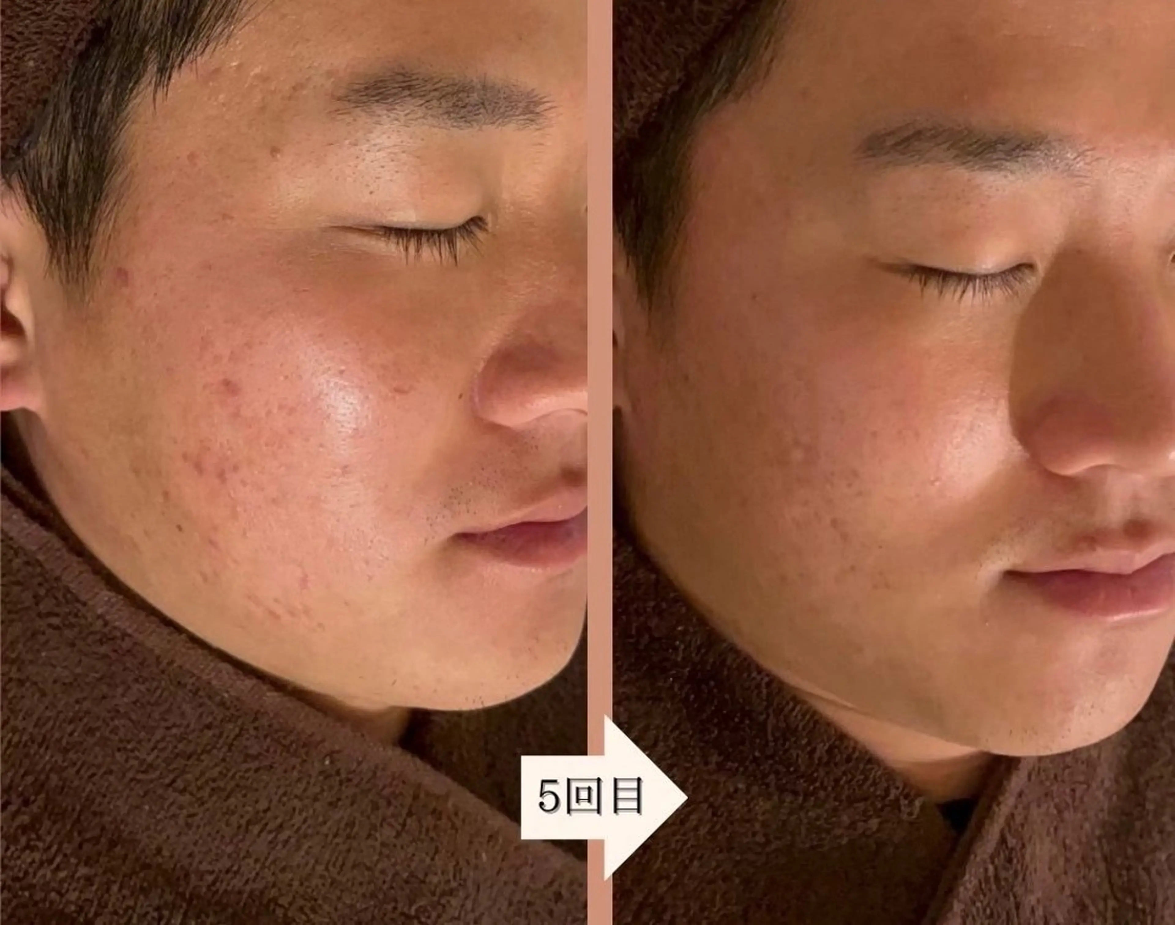 ENoa ハーブピーリング専門のエステ・リラクイメージ