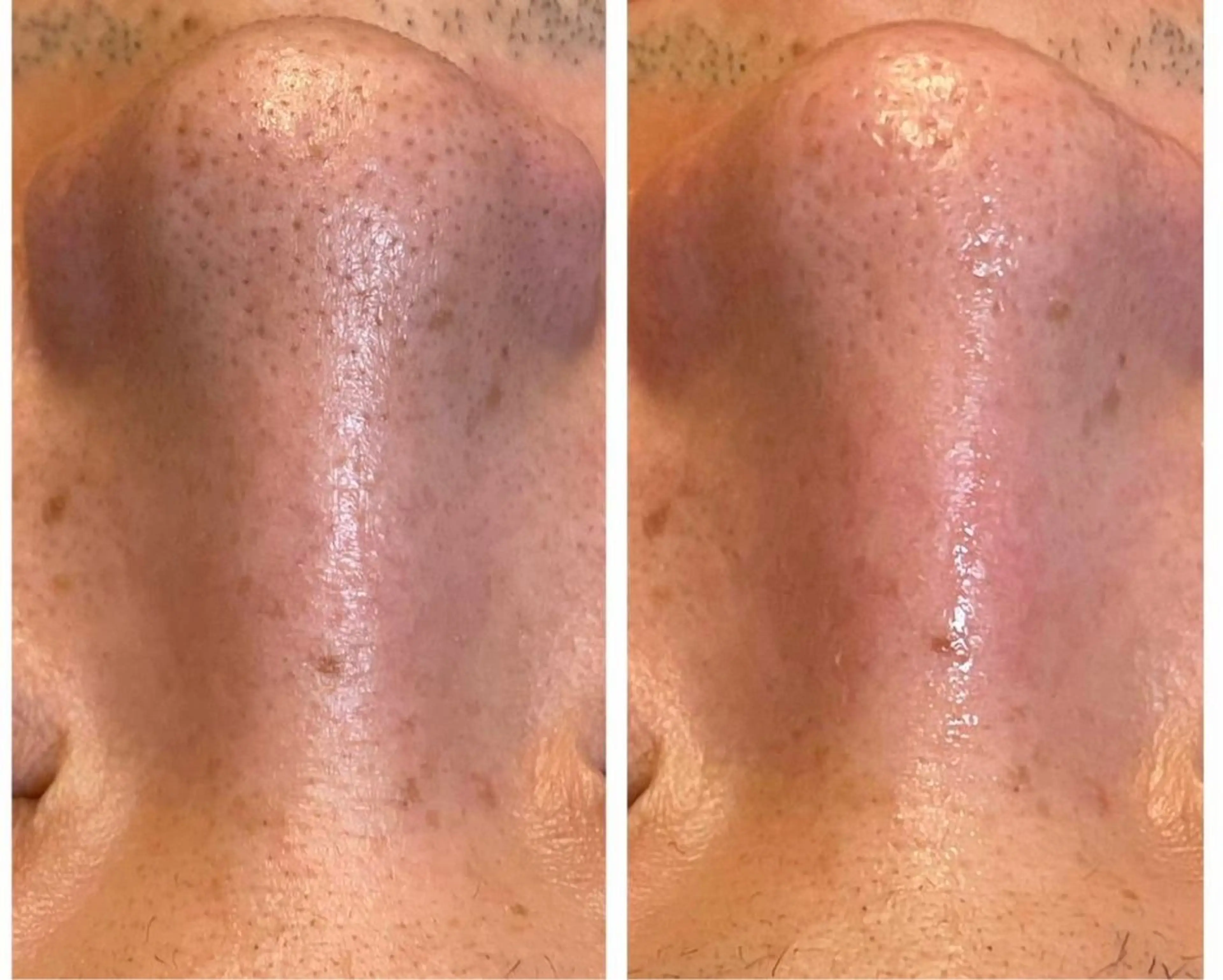 エステ トータルビューティーサロンFirstclass所属・Firstclass Erikaのエステ・リラクイメージ