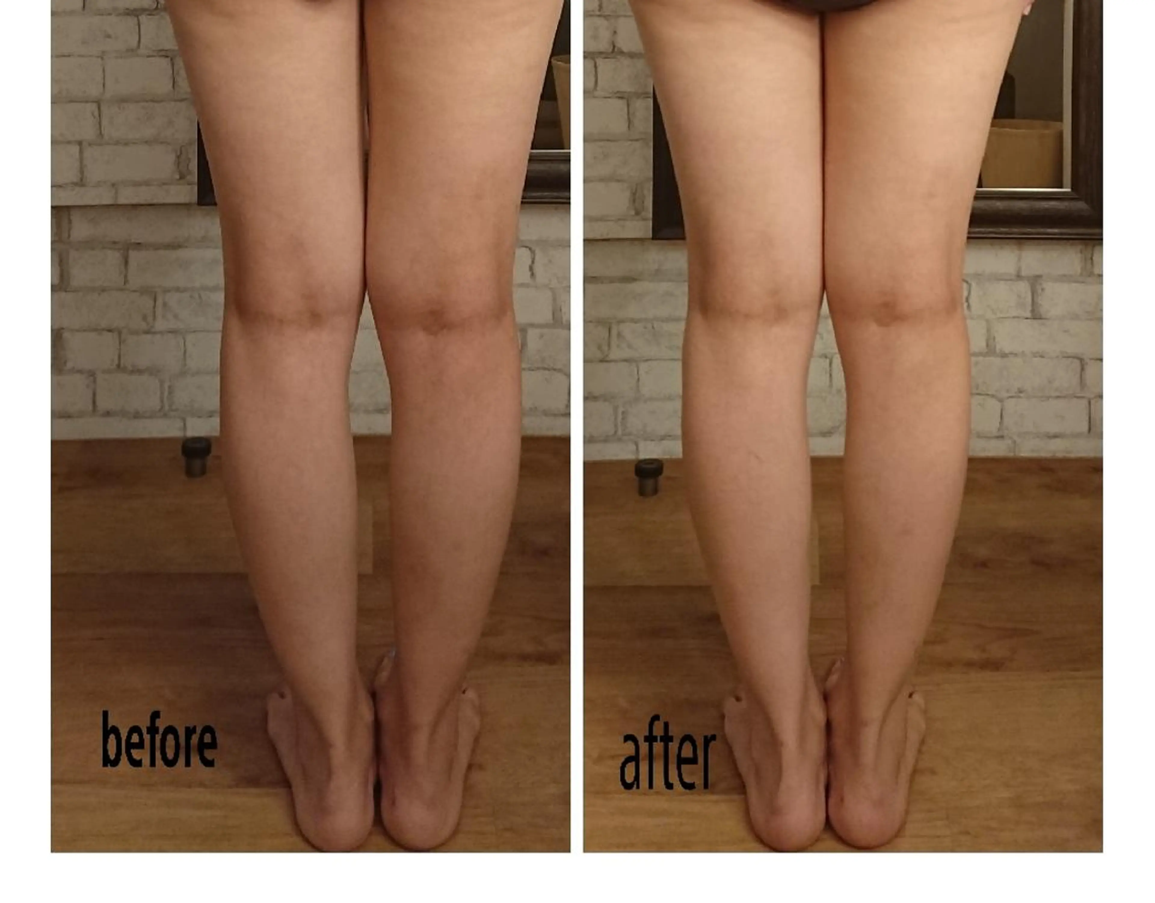 エステ リラク 美容矯正 QUICO【キコ】のその他イメージ