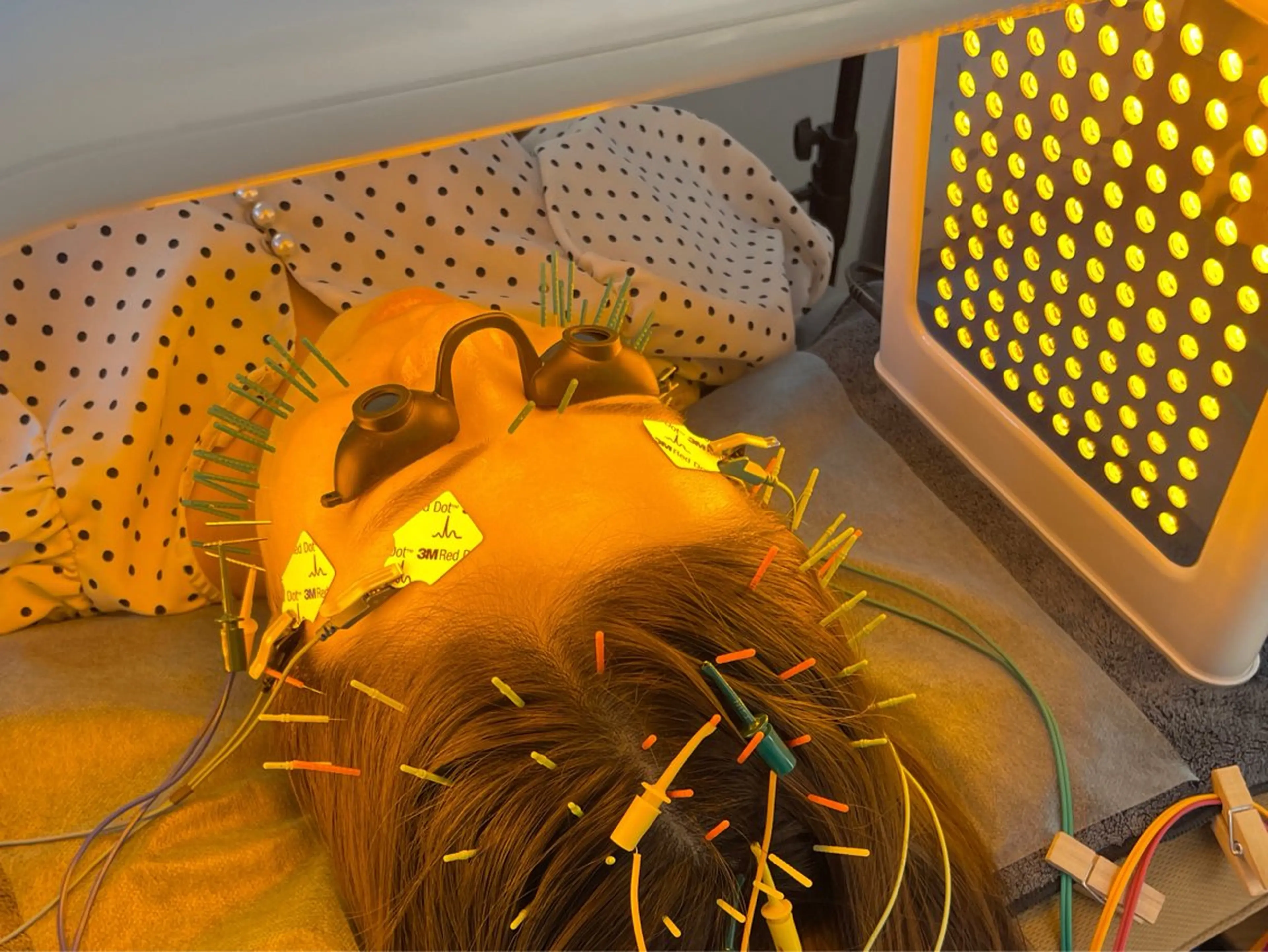 撮影モデル 小顔美容鍼専門サロン 渋谷YZのエステ・リラクイメージ