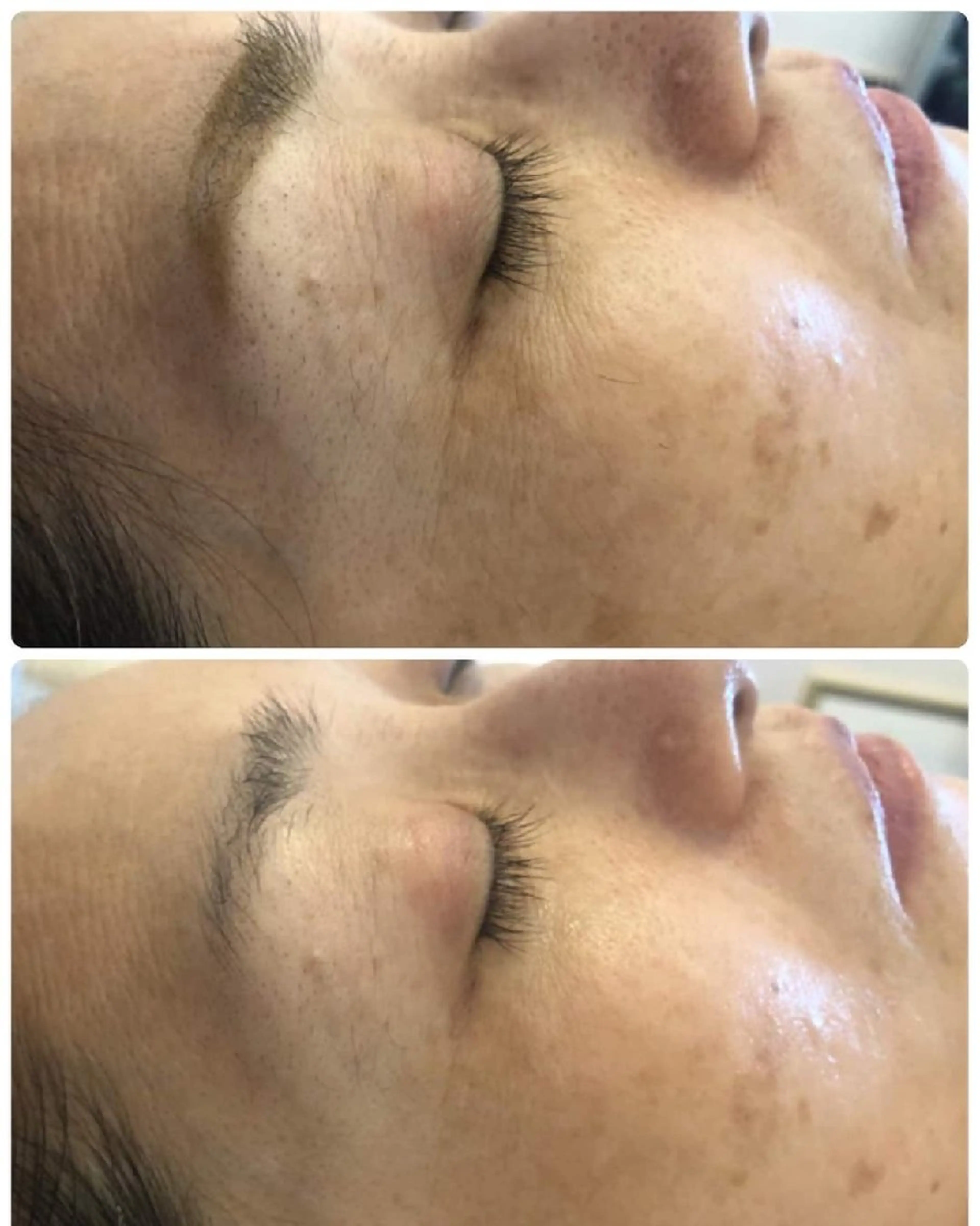 Biestora 郡山店/橋本のエステ・リラクイメージ