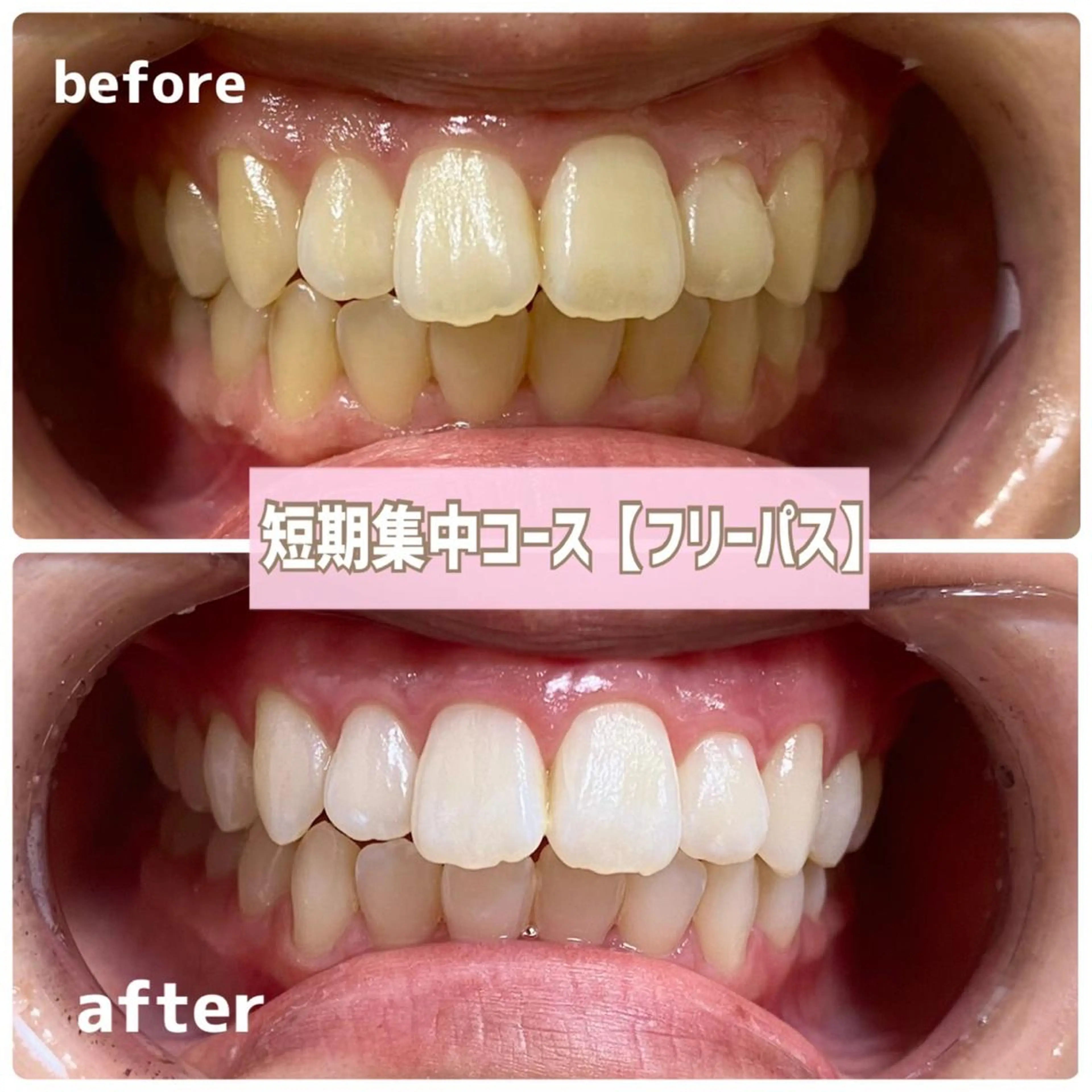 その他 ホワイトニングサロン BE WHITE金山のその他イメージ