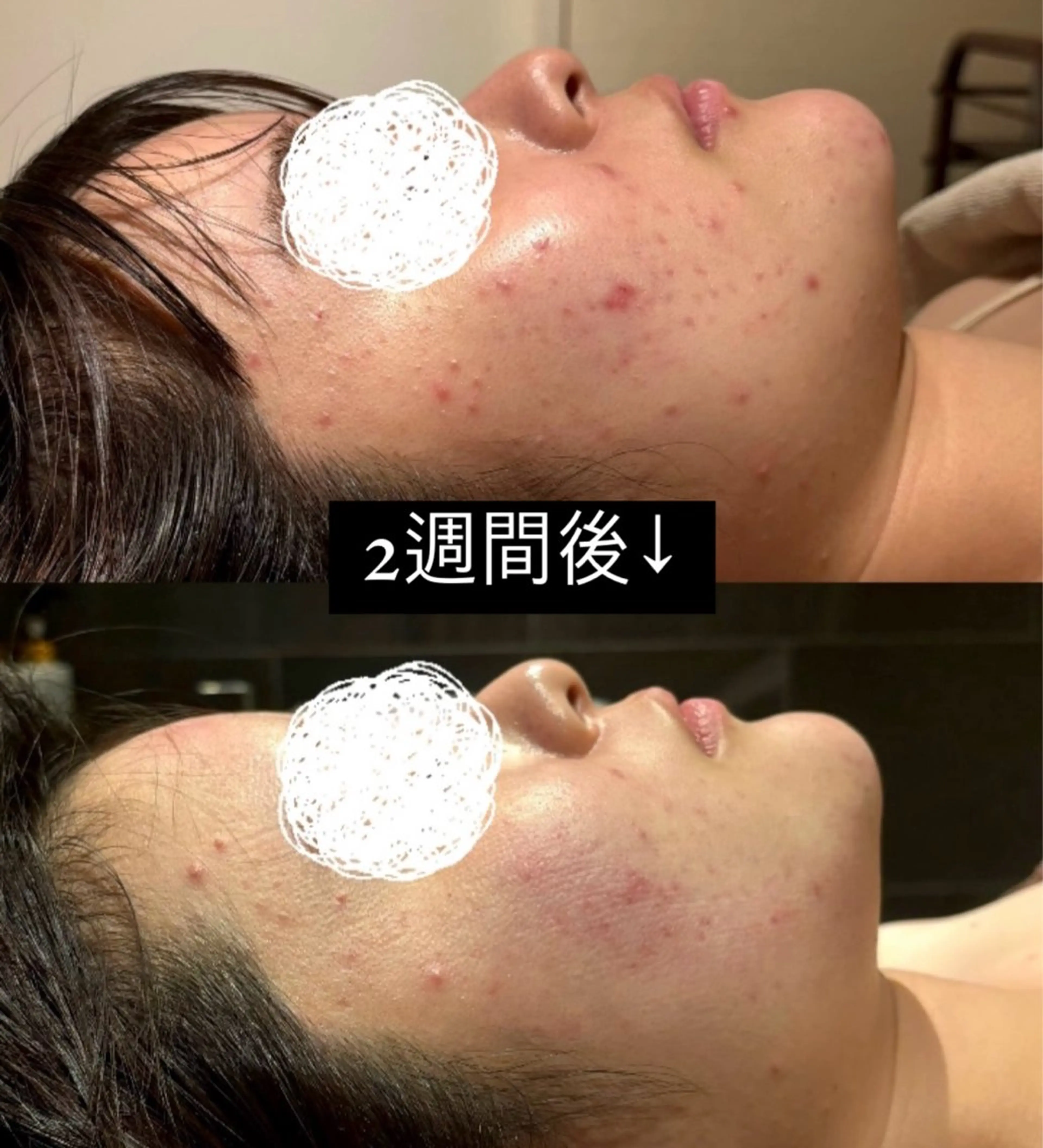 Hari Lounge恵比寿所属・chika🦋 ハリラウンジ恵比寿のエステ・リラクイメージ