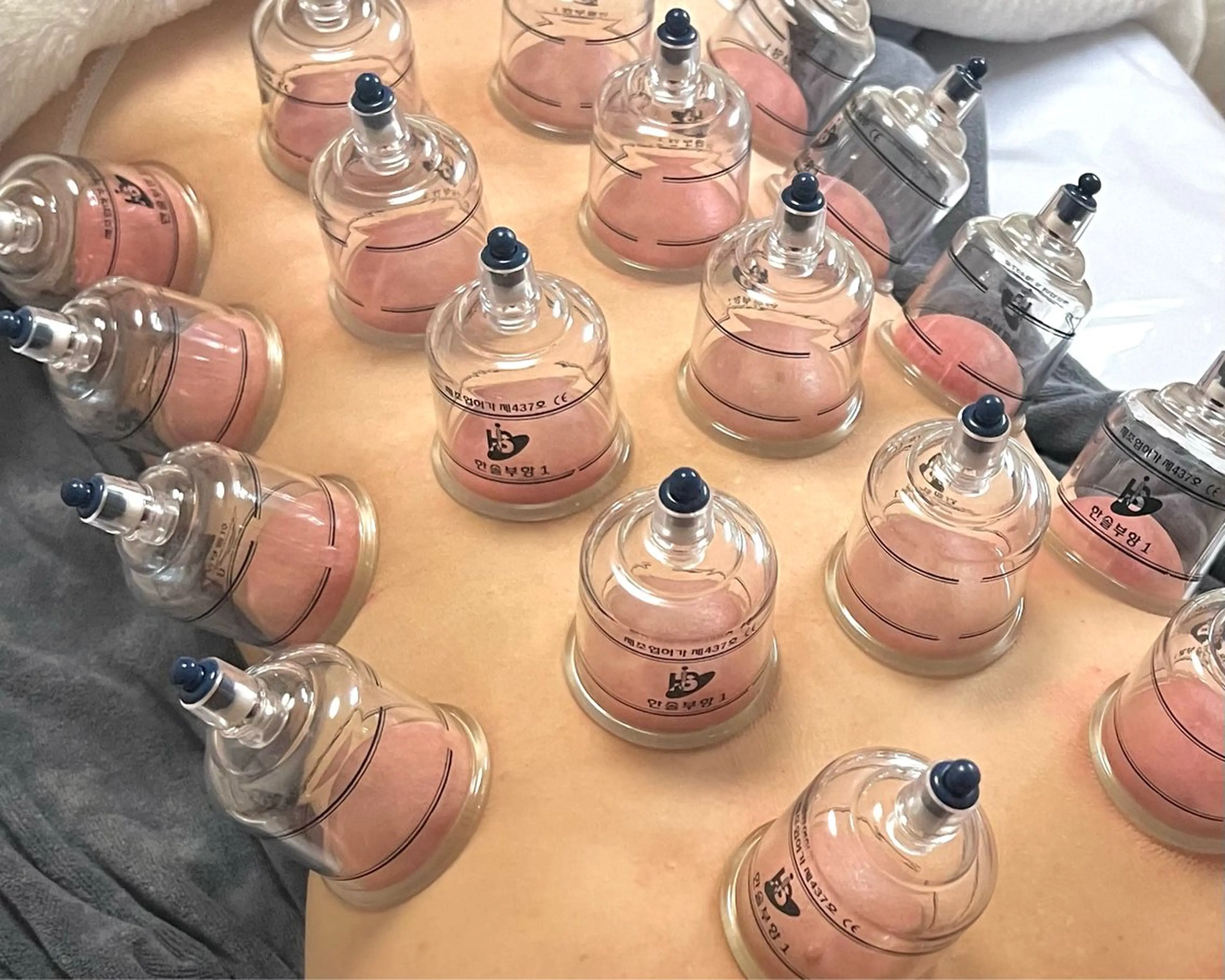 むくみ・肩こり・腰痛【カッピングコース】オイル60分の写真