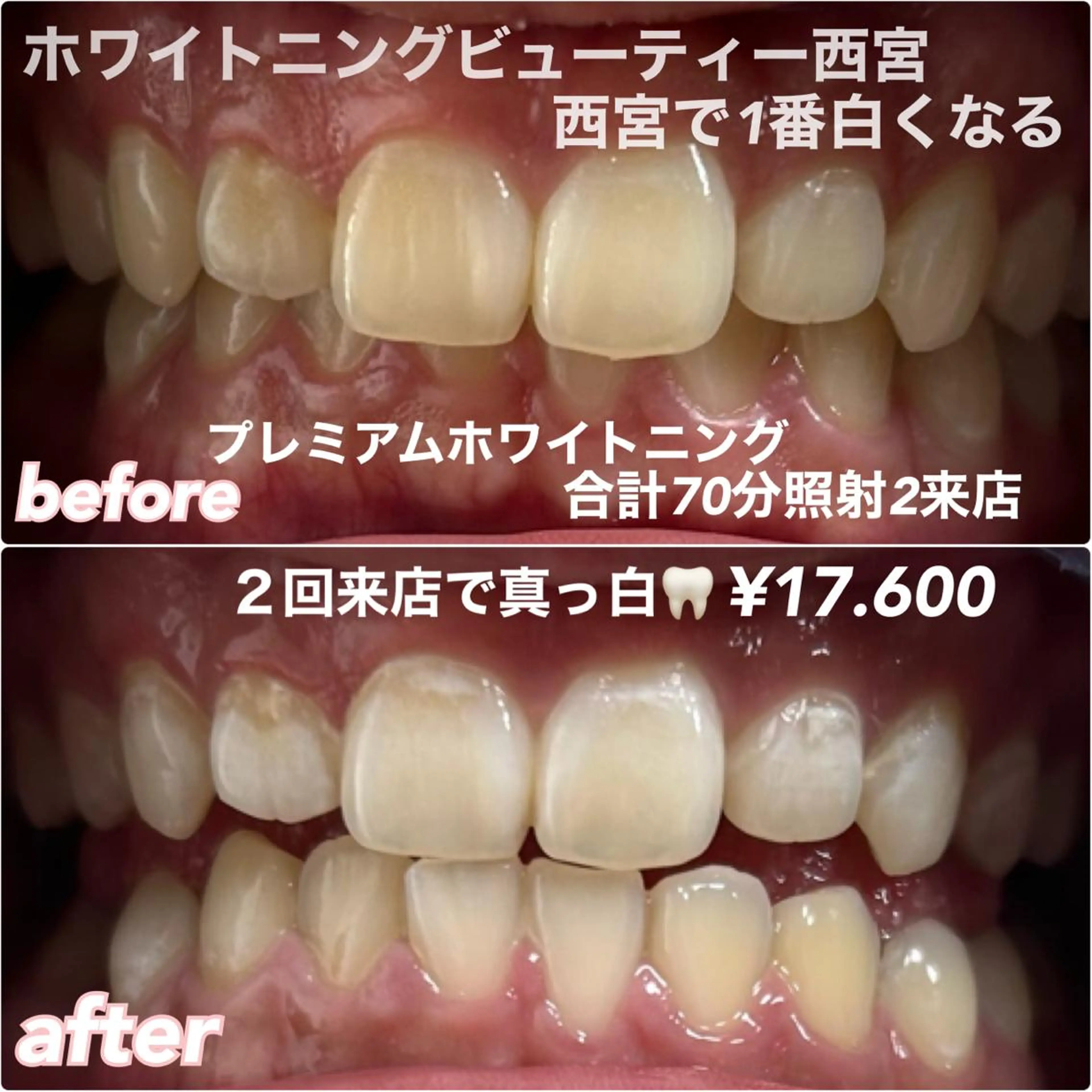 ホワイトニングビューティー西宮店所属・ホワイトニングビュー ティー西宮店のその他イメージ