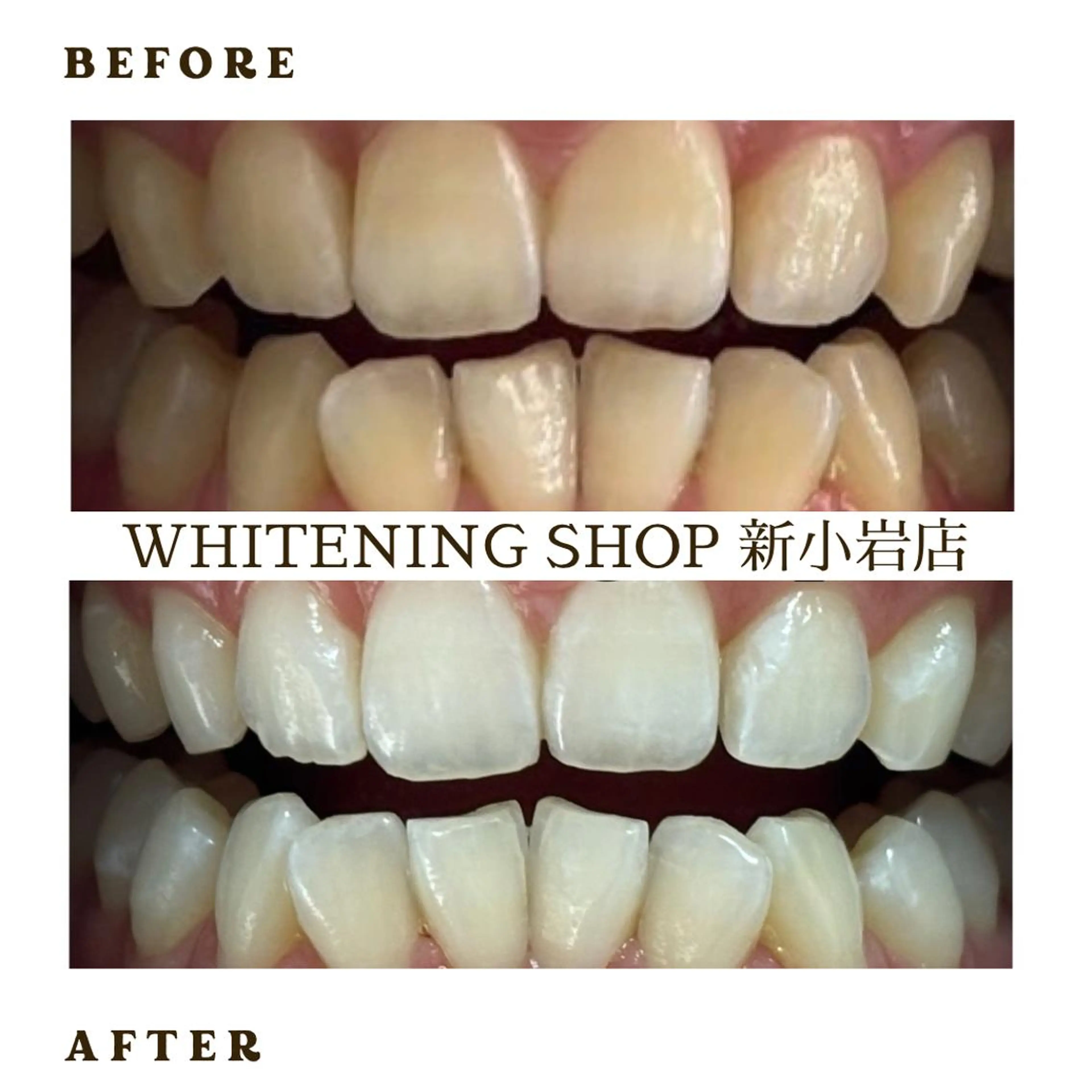 メンズ その他 ホワイトニング ショップ新小岩店のその他イメージ
