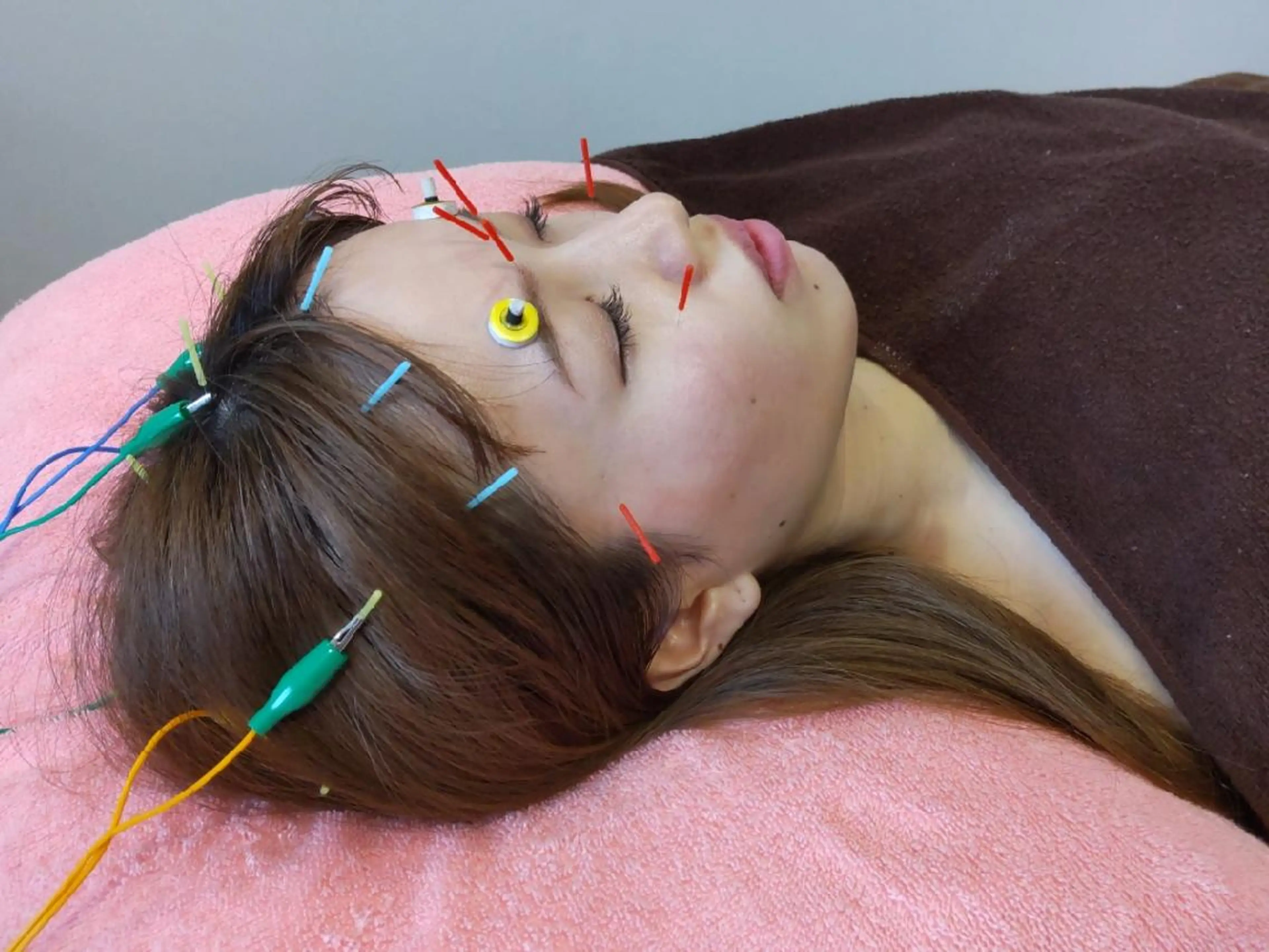 ソリーシェ鍼灸院 上野・稲荷町のエステ・リラクイメージ