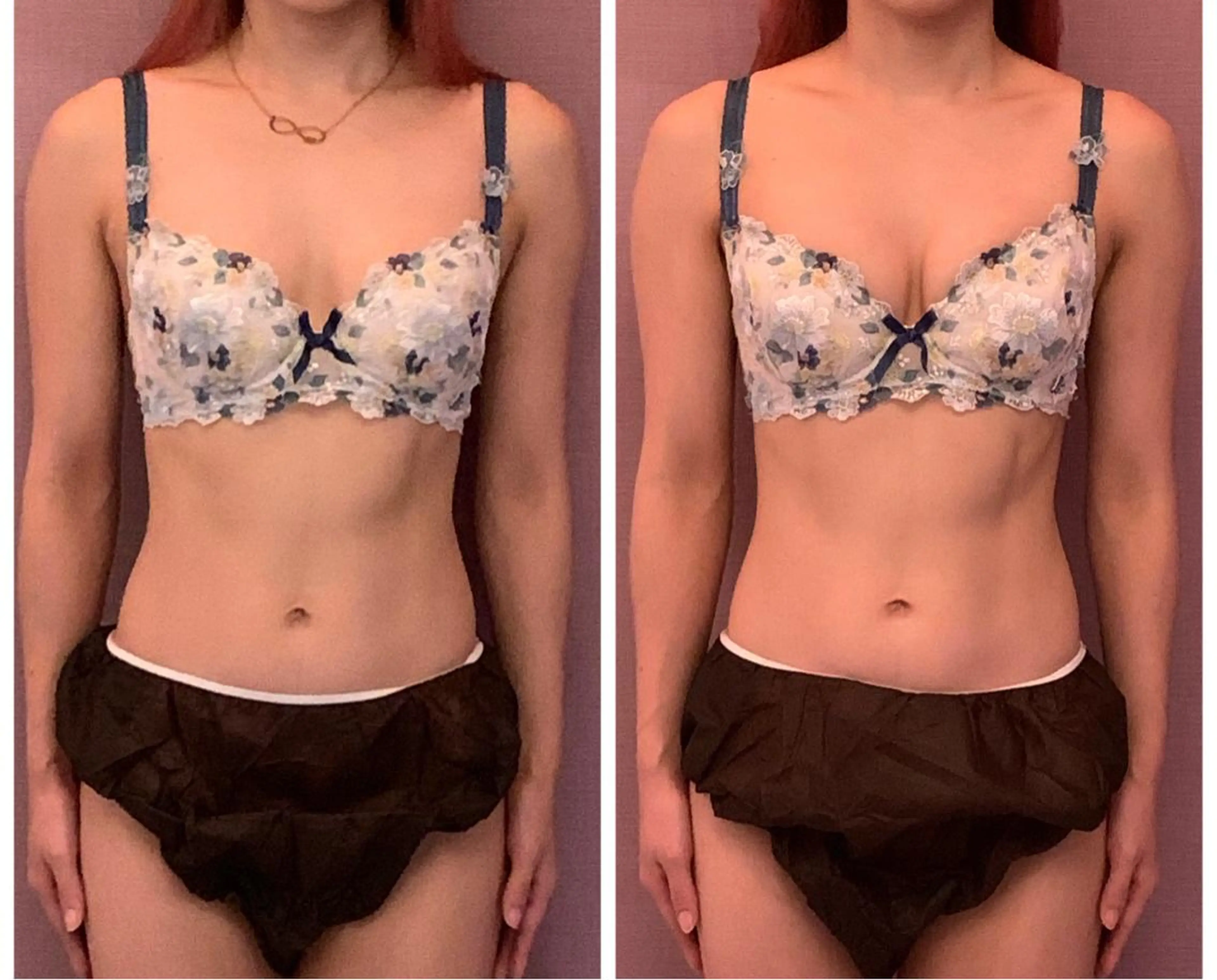 エステ リラク アンベリーノ Yuuriのエステ・リラクイメージ