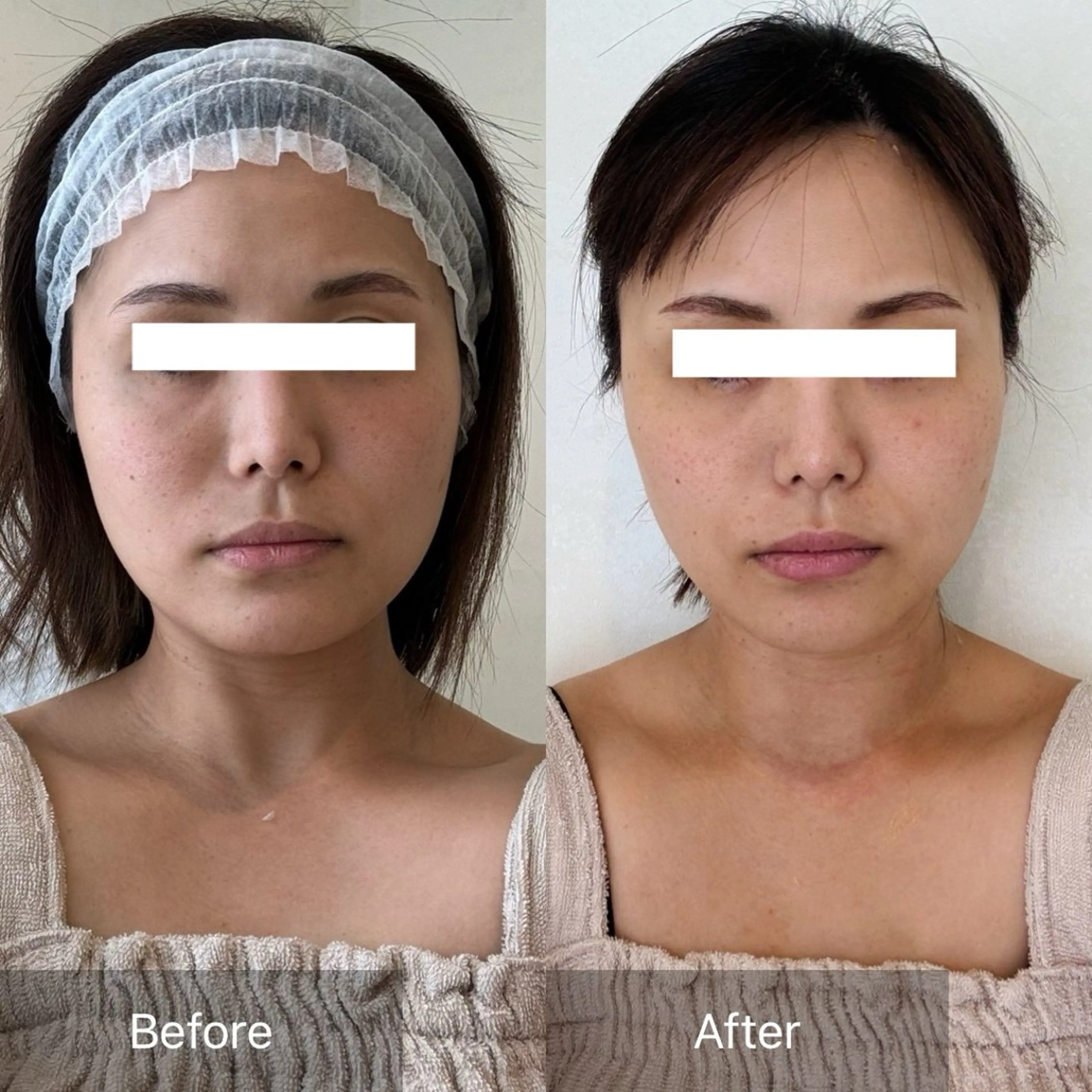 Charis エステ&ネイルのエステ・リラクイメージ