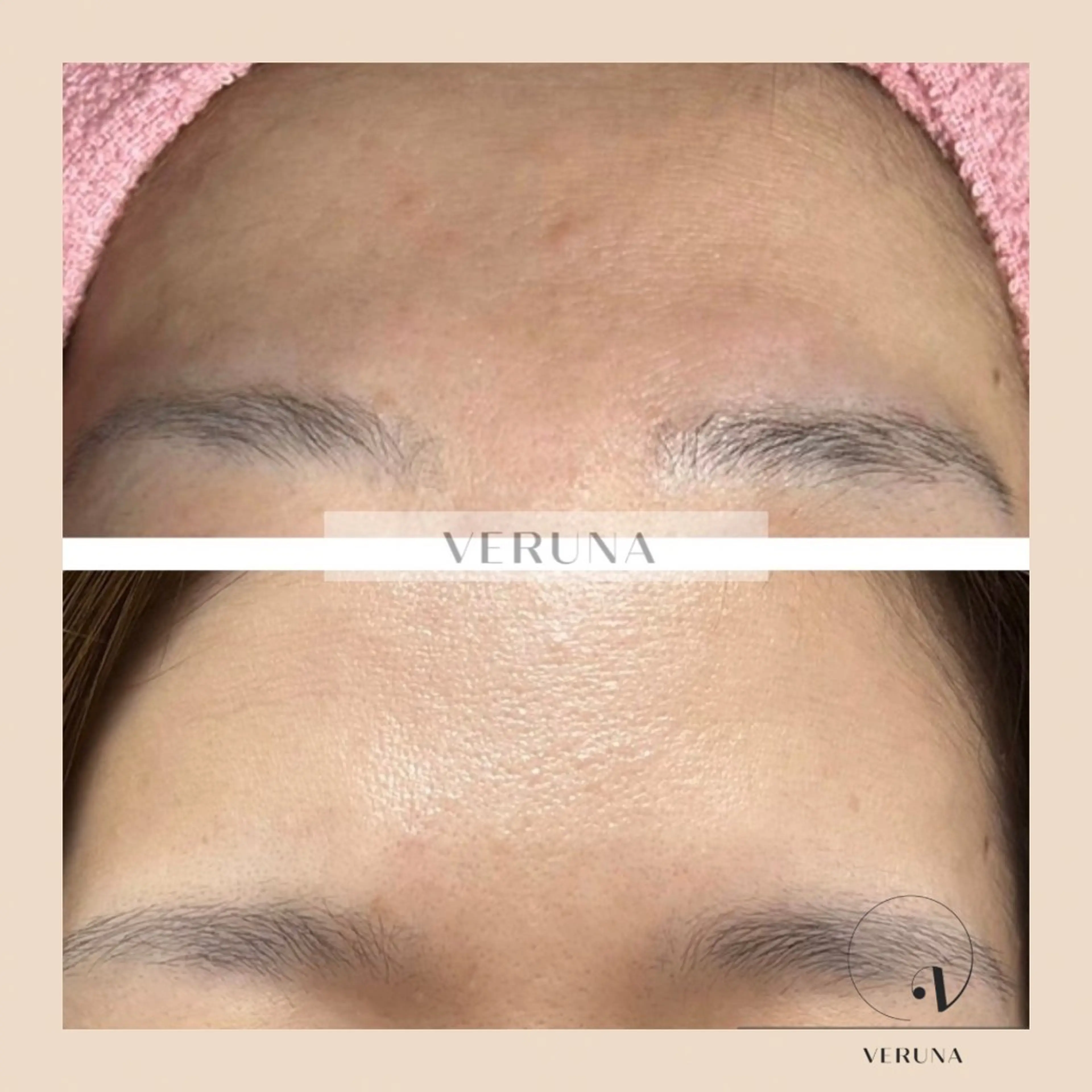 エステ リラク ピーリング専門店 Belluteのエステ・リラクイメージ