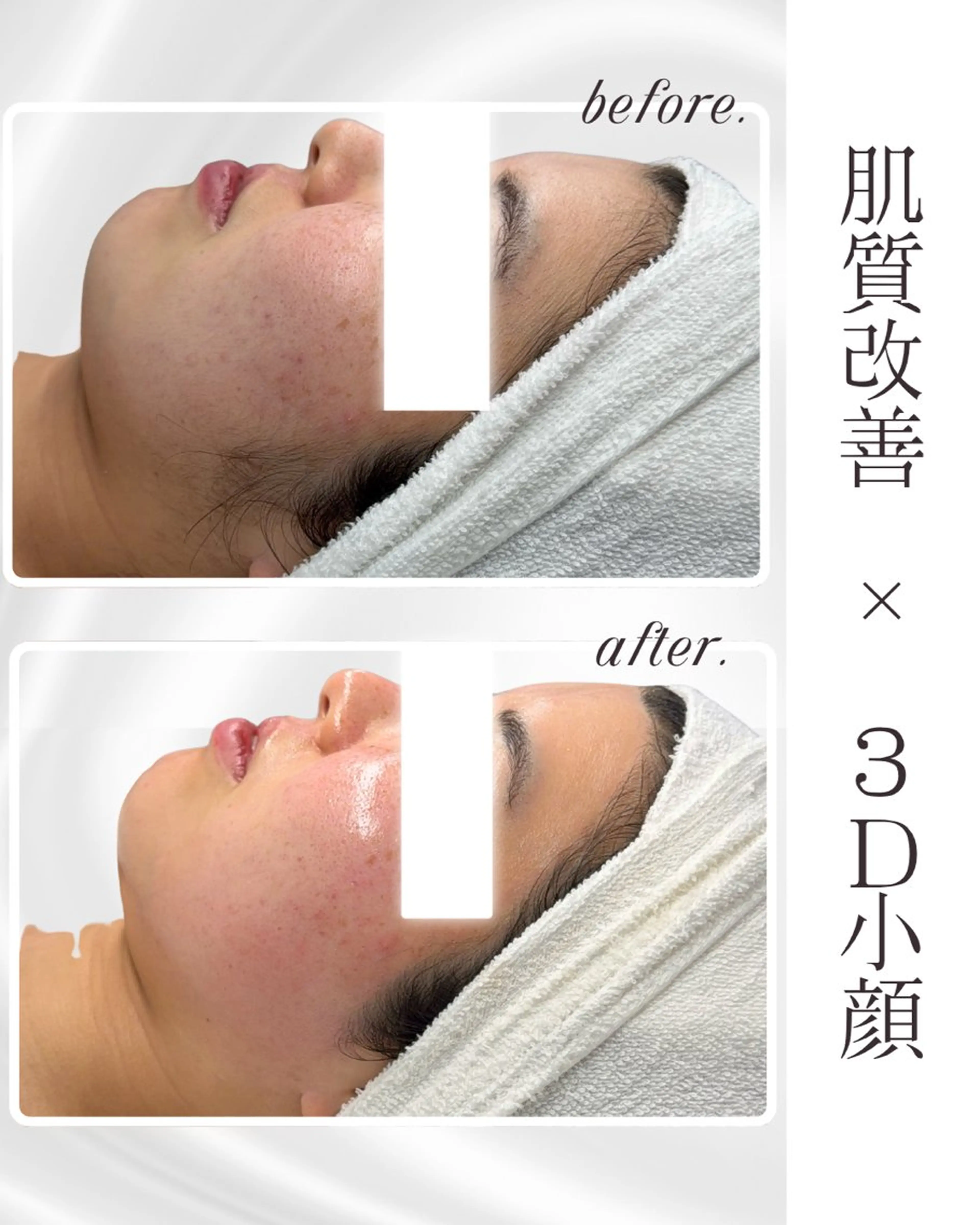 Liam《美肌管理/ 3D小顔/脂肪ケア》のエステ・リラクイメージ