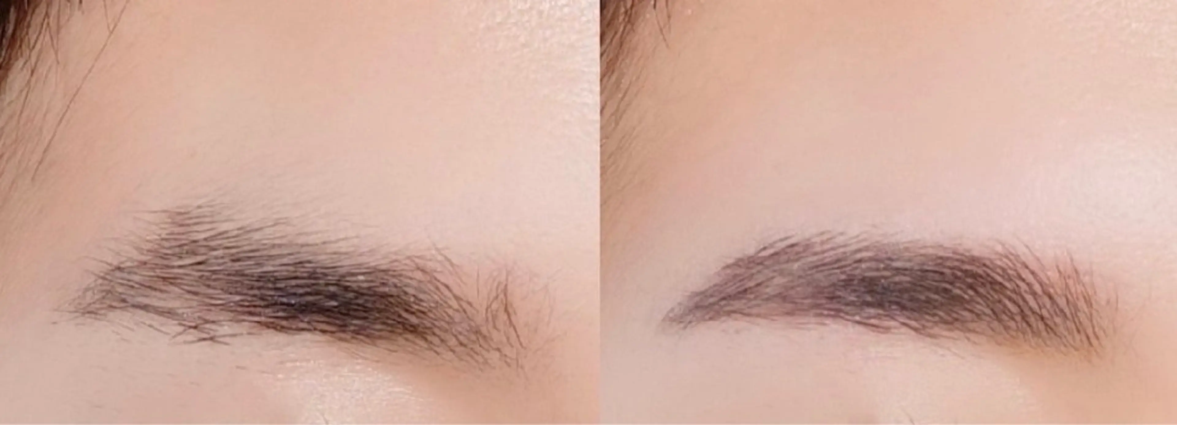 アイブローワックス脱毛の写真