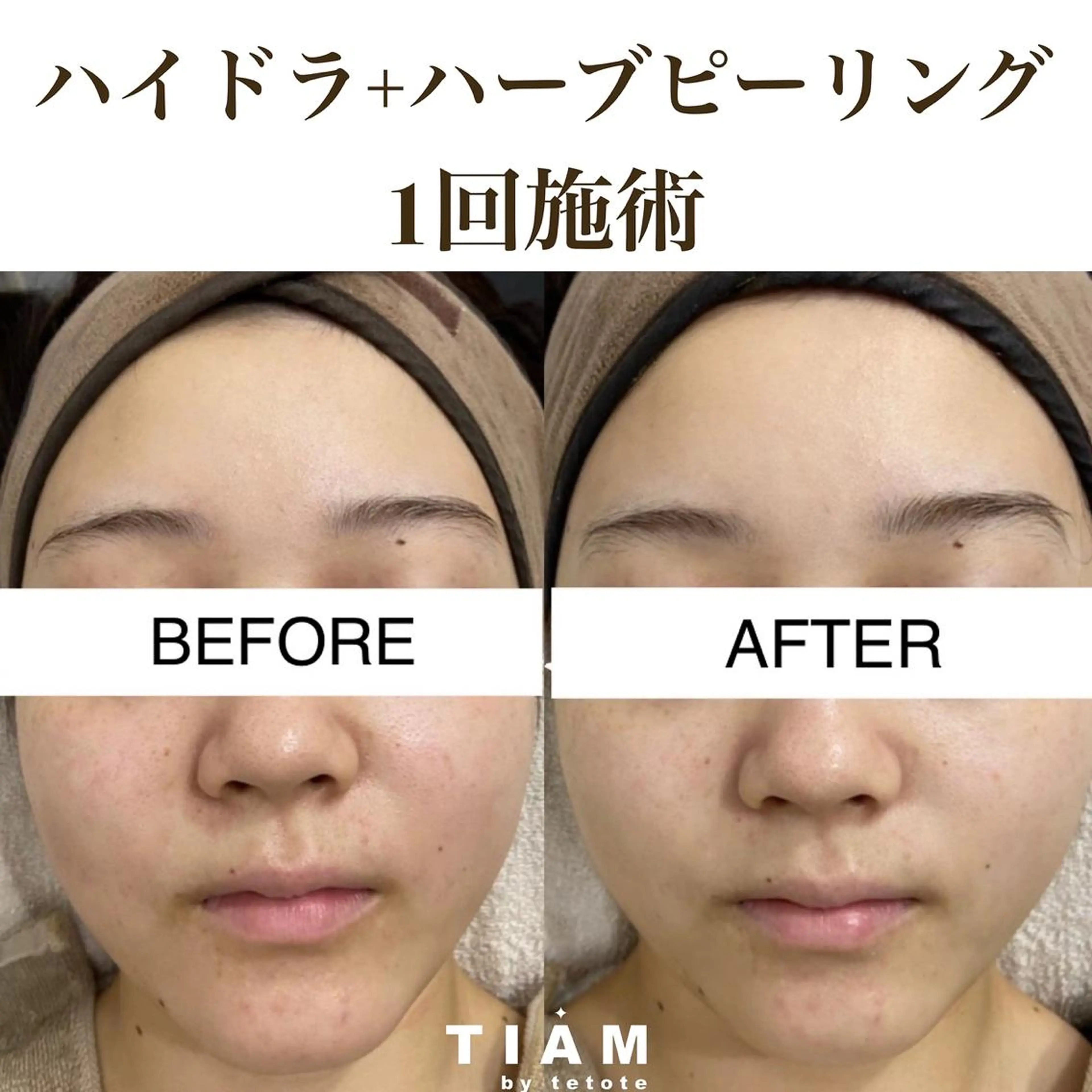 美肌サロンTIAM by tetoteのエステ・リラクイメージ