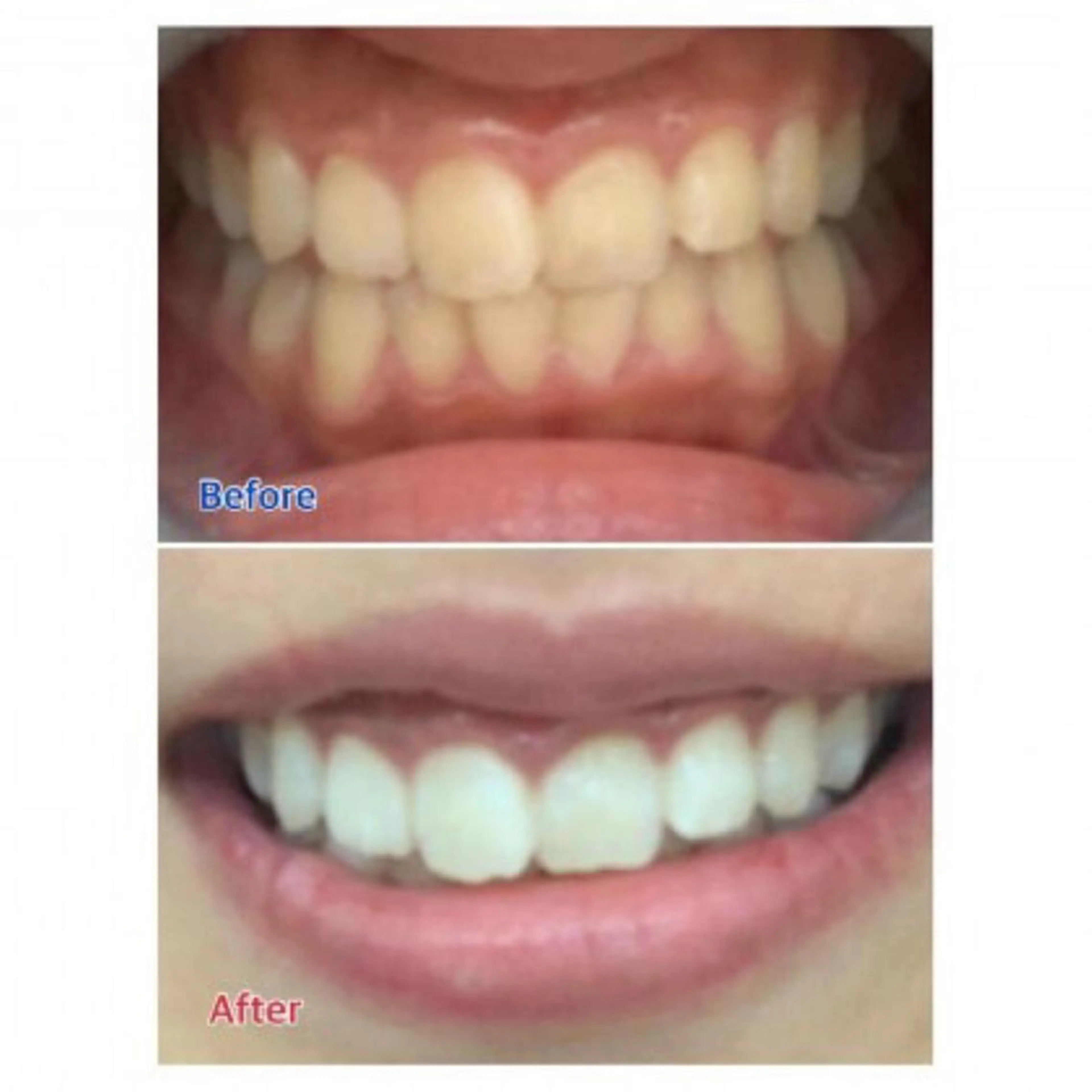 M渋谷店所属・Ｍ渋谷 ホワイトニングのエステ・リラクイメージ