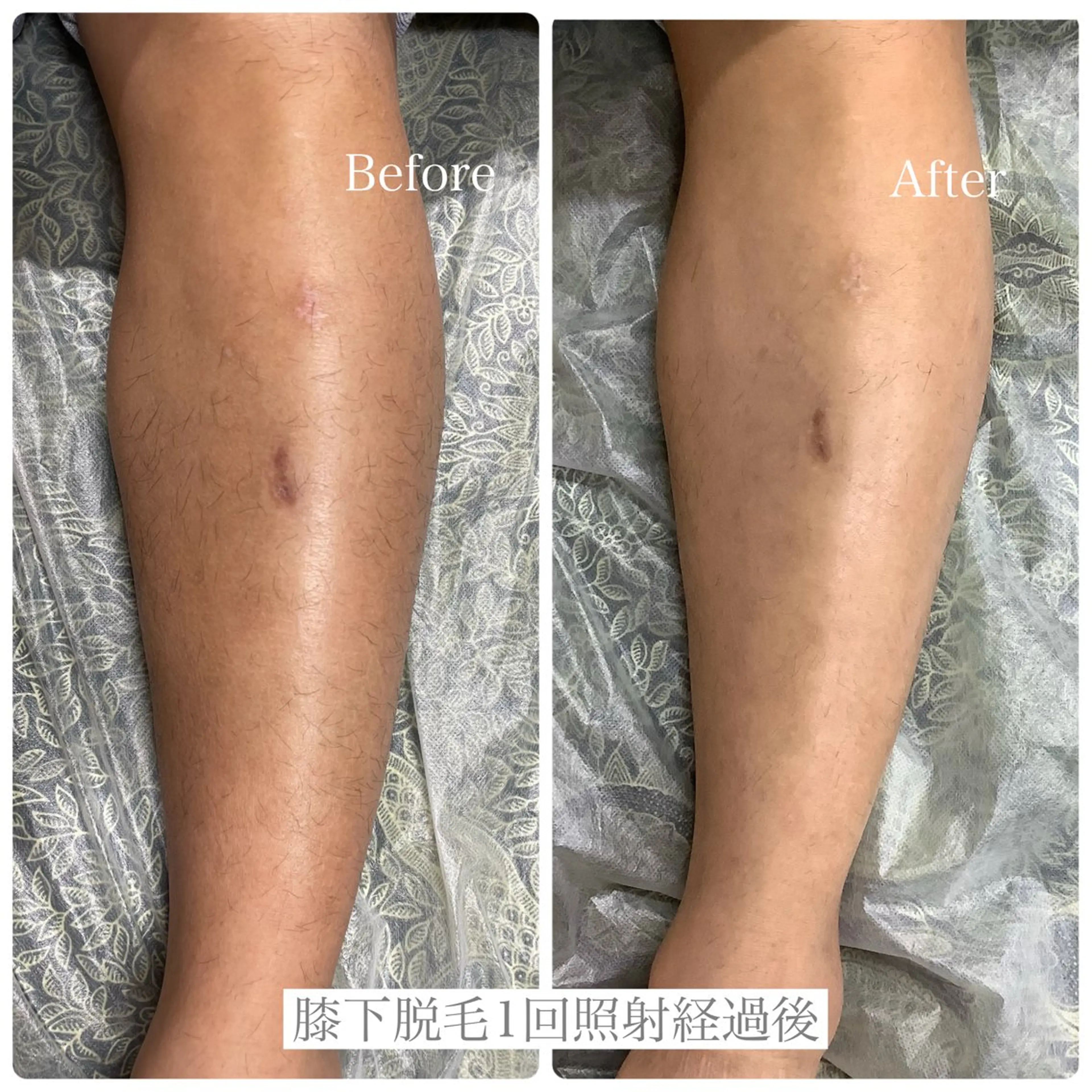 DISINI  SPA所属・DISINISPA 脱毛/フェイシャルのエステ・リラクイメージ