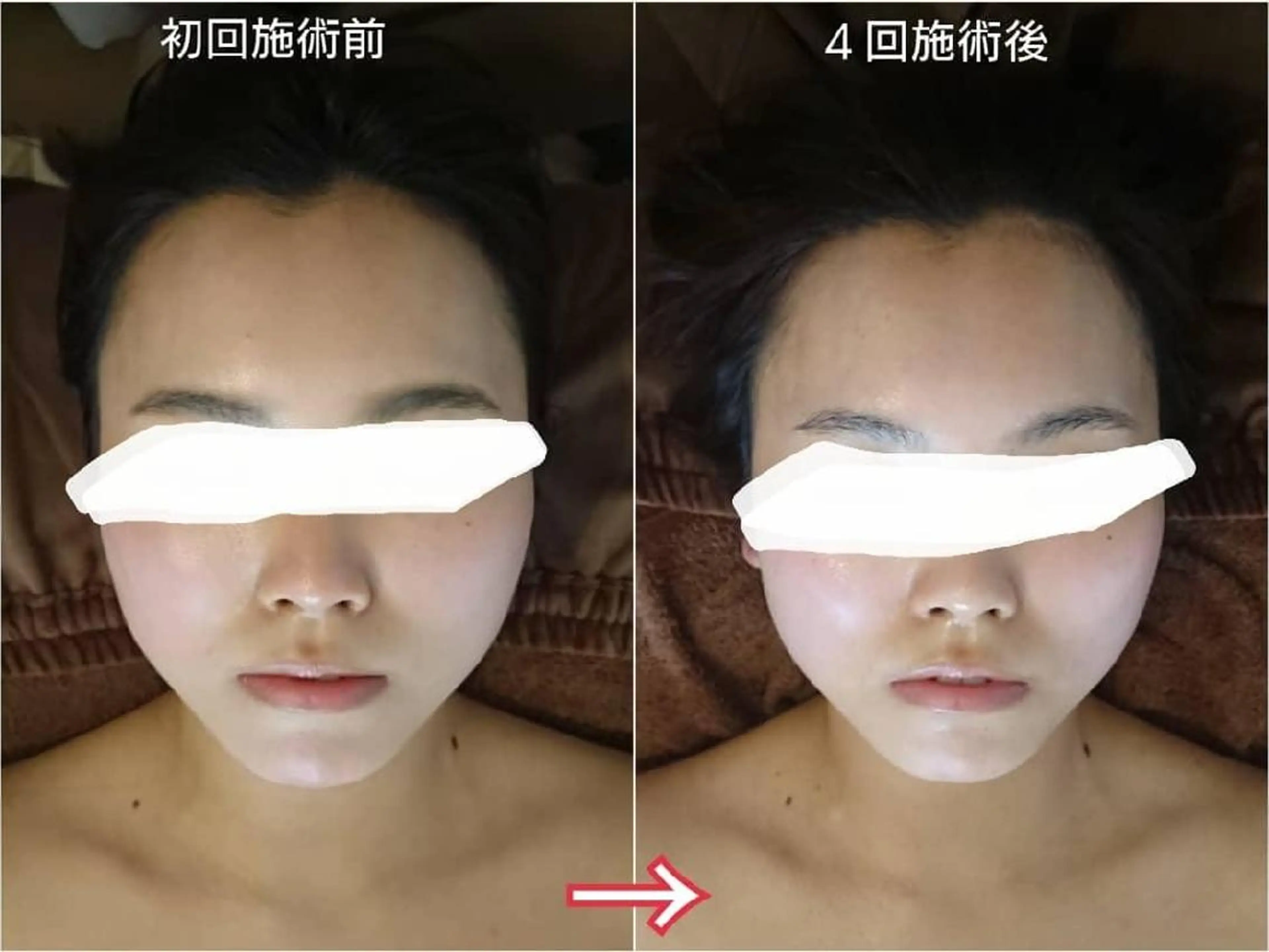 Jeliss~美爪育成ネイル＆頭蓋骨小顔矯正サロン~所属・美顔(小顔)矯正& 美爪育成Jelissのエステ・リラクイメージ