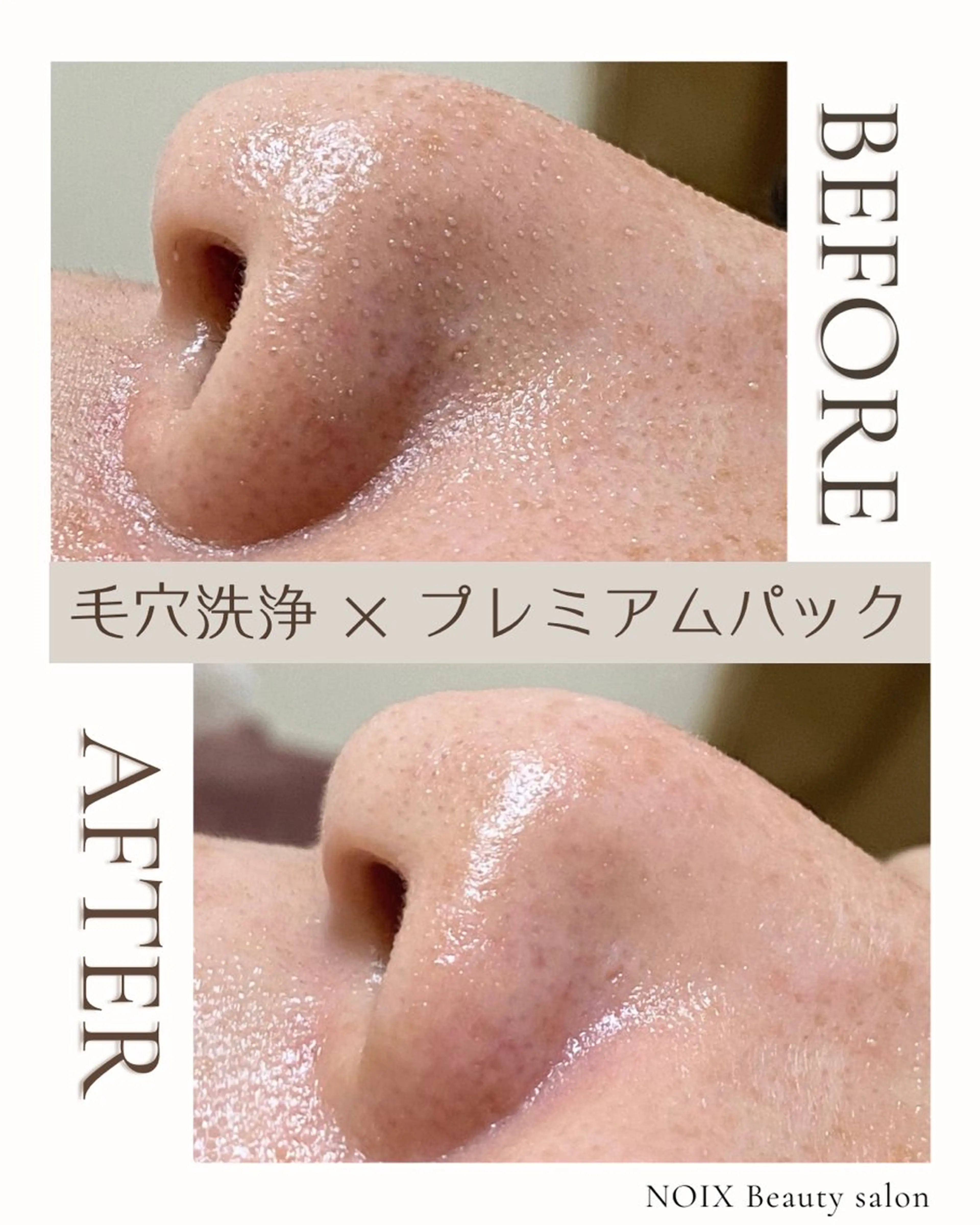 NOIXbeauty salonのエステ・リラクイメージ