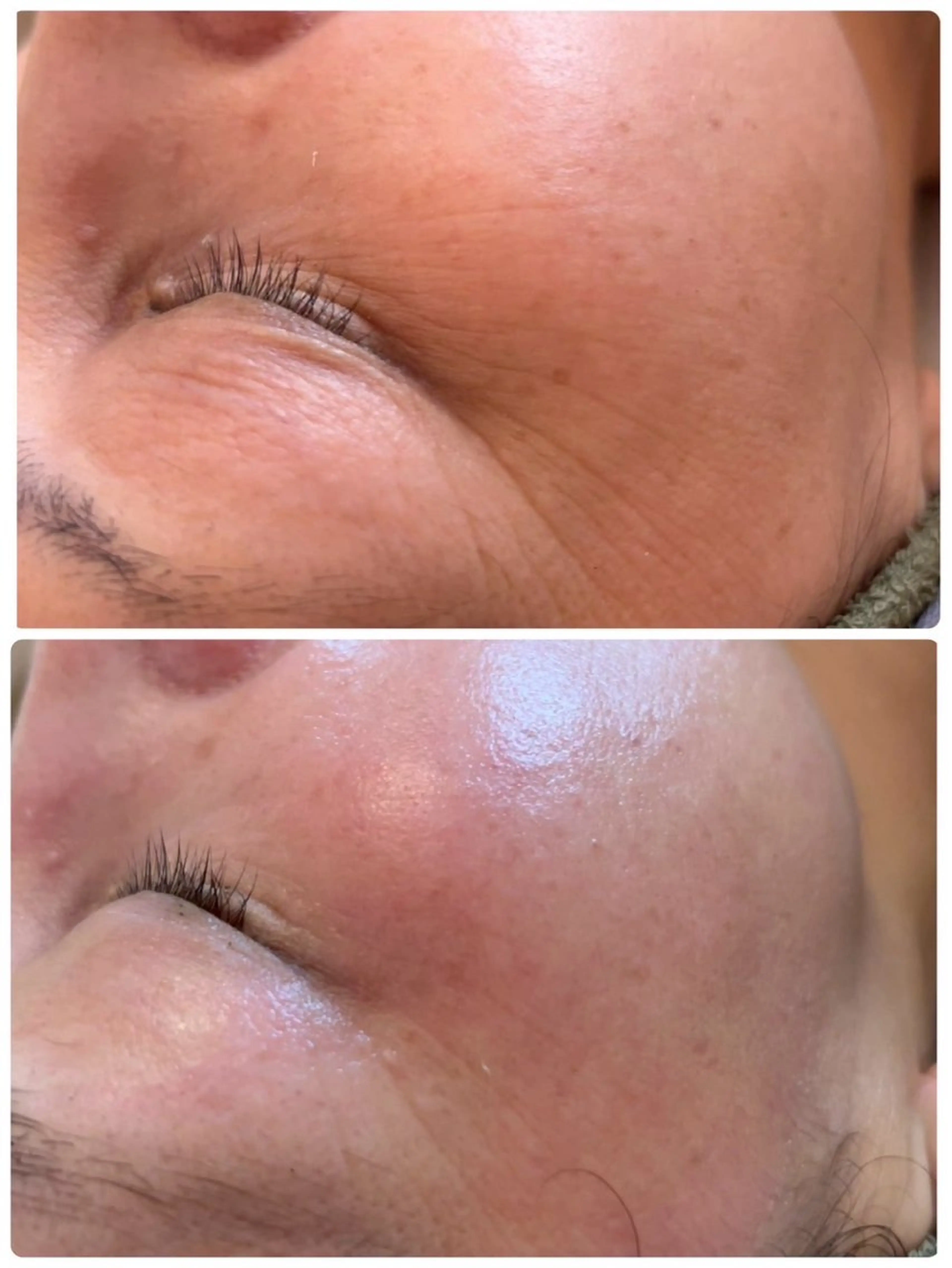 肌質改善サロン Manaririoのエステ・リラクイメージ