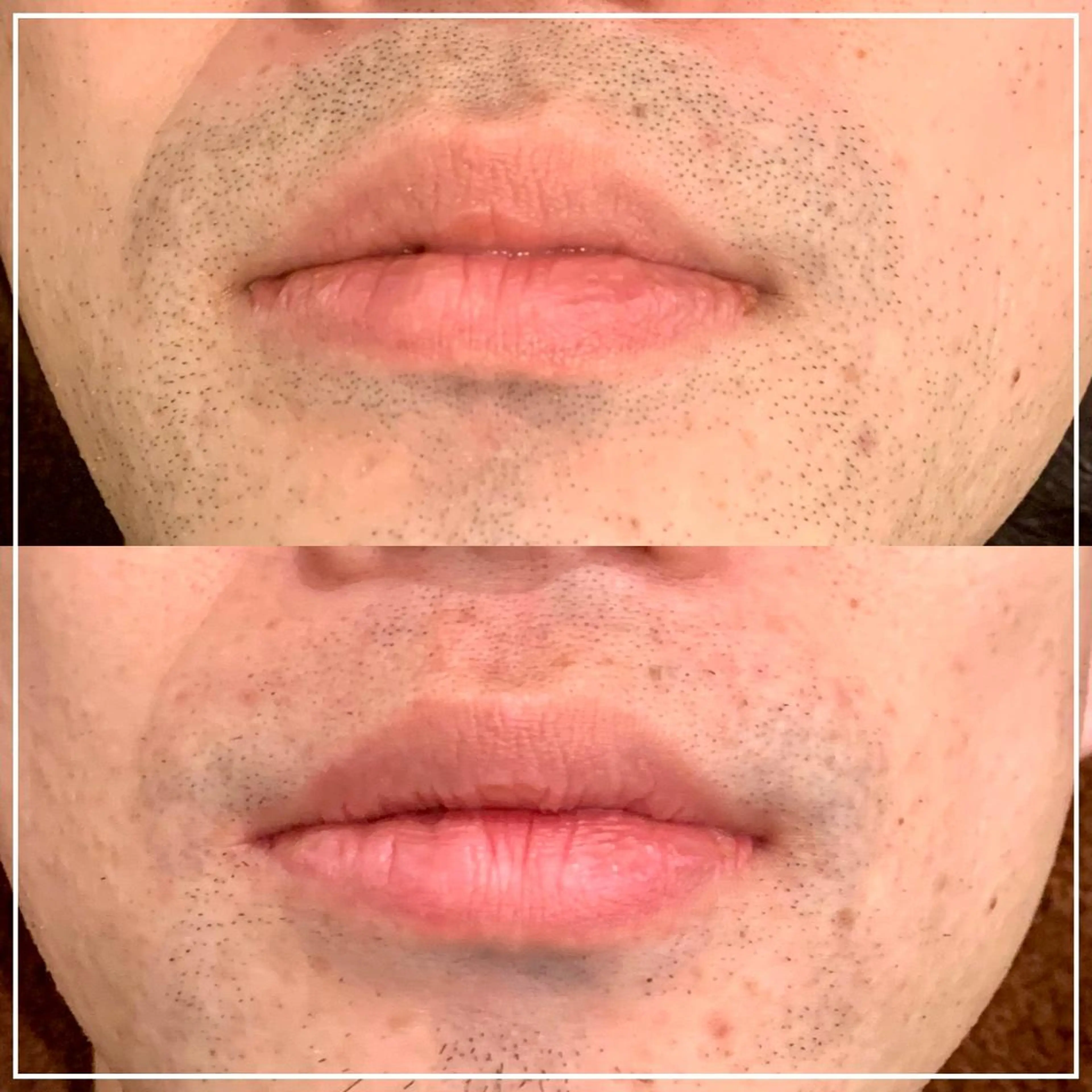 メンズ RICCO 堺東所属・RICCO 堺の眉毛・アイブロウイメージ