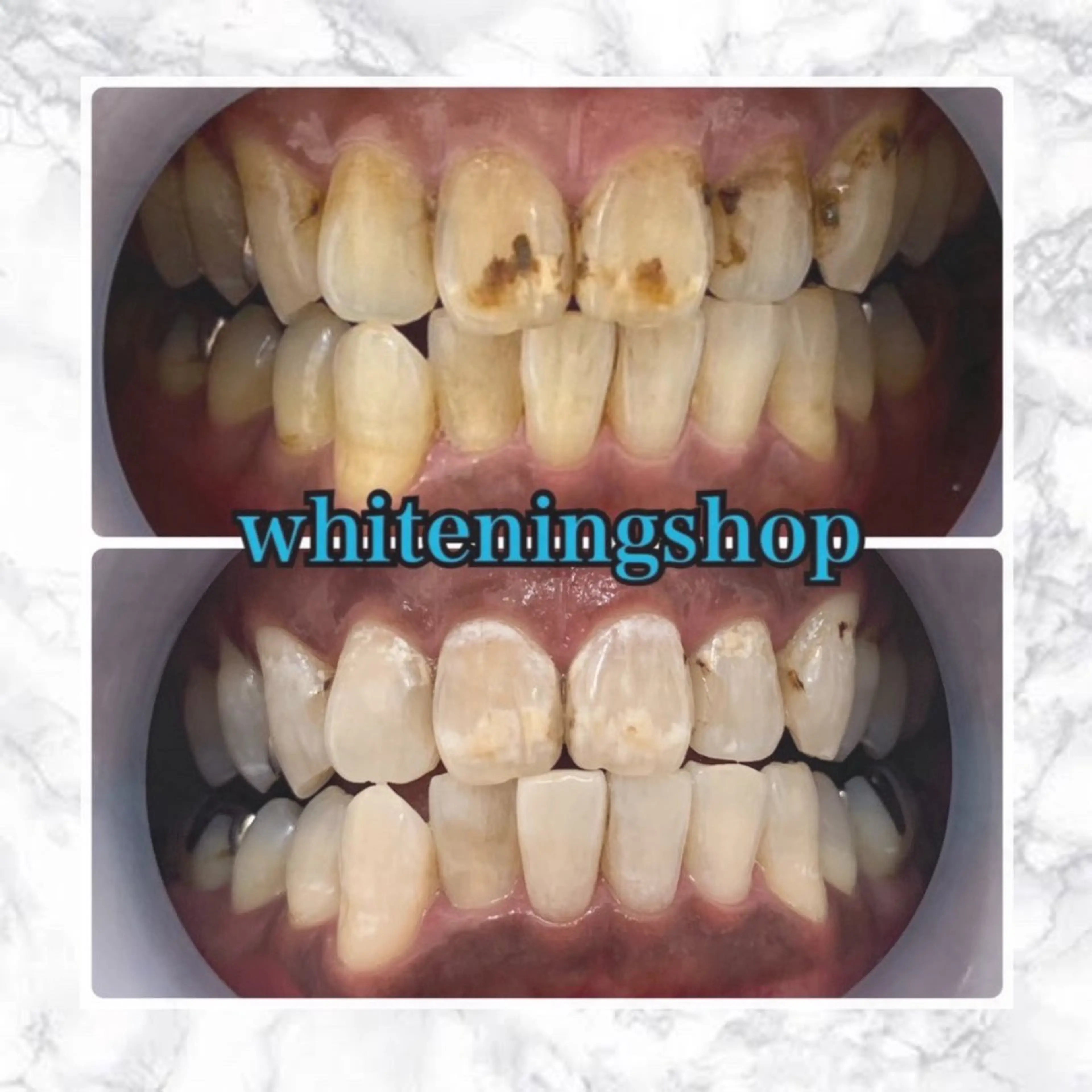 その他 ホワイトニングショップ津店所属・ホワイトニング ショップ津店のその他イメージ