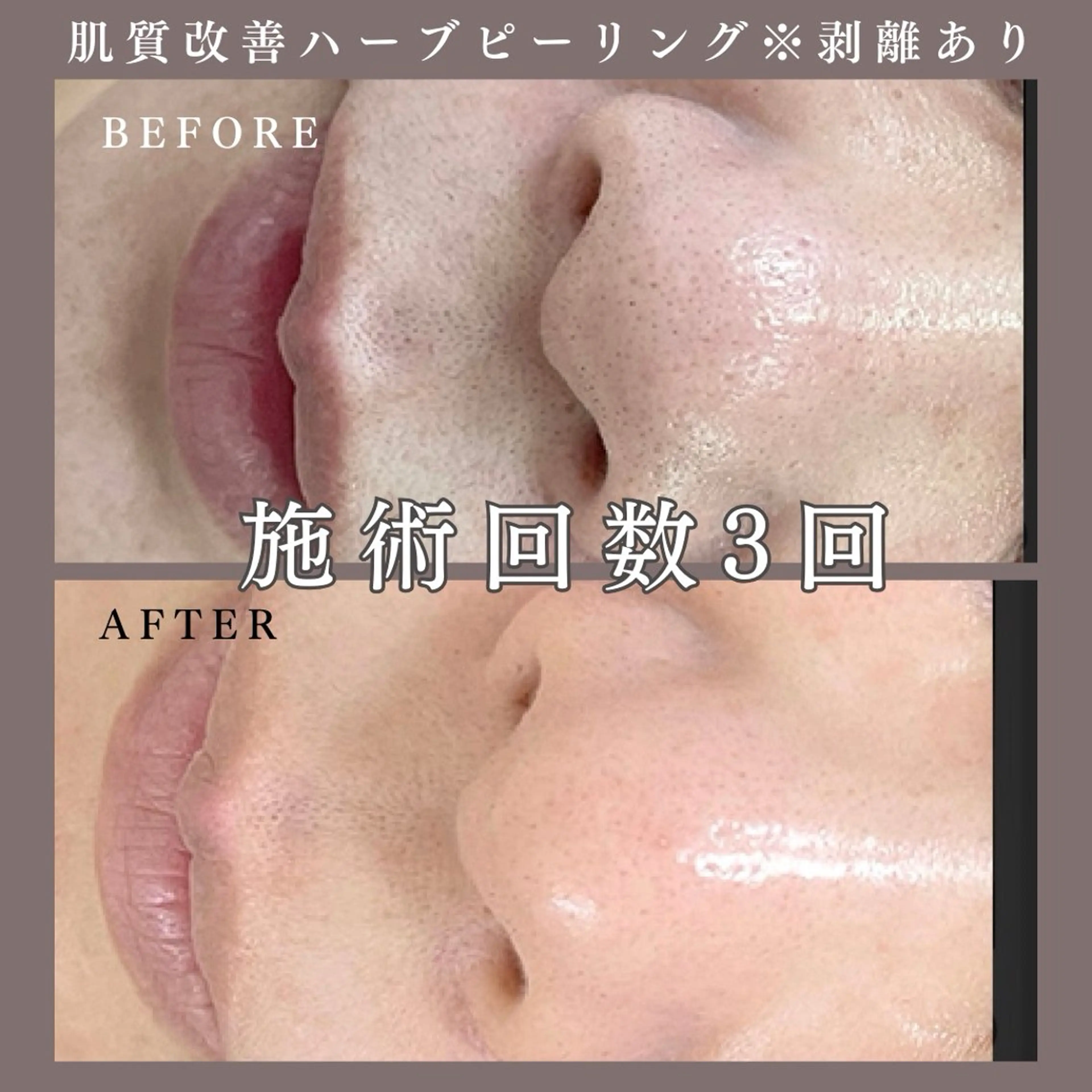 肌質改善専門サロン Bellmi/心斎橋のエステ・リラクイメージ