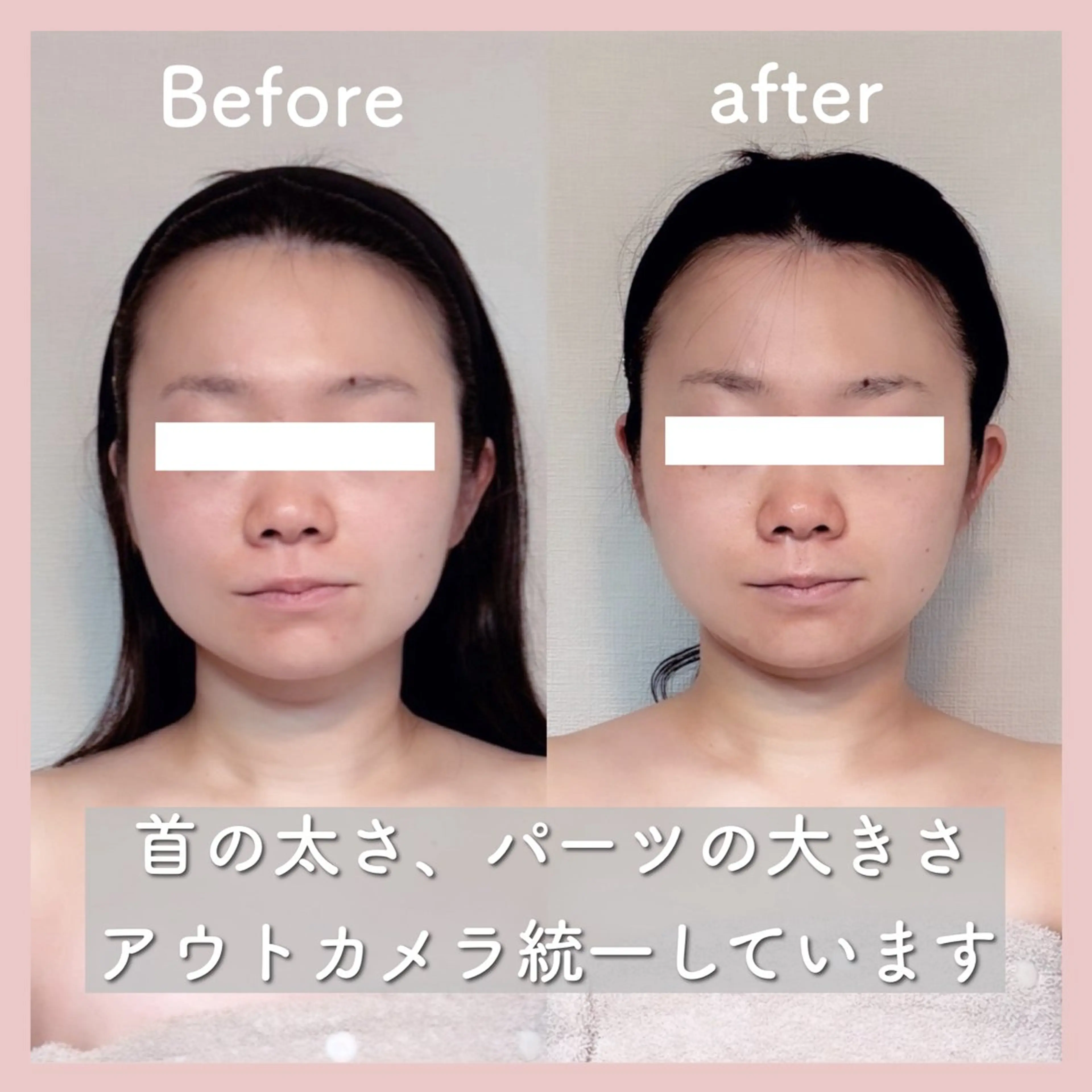 エステ リラク 小顔矯正専門店Gémiey所属・越谷駅徒歩３分 小顔専門Gemieyのエステ・リラクイメージ