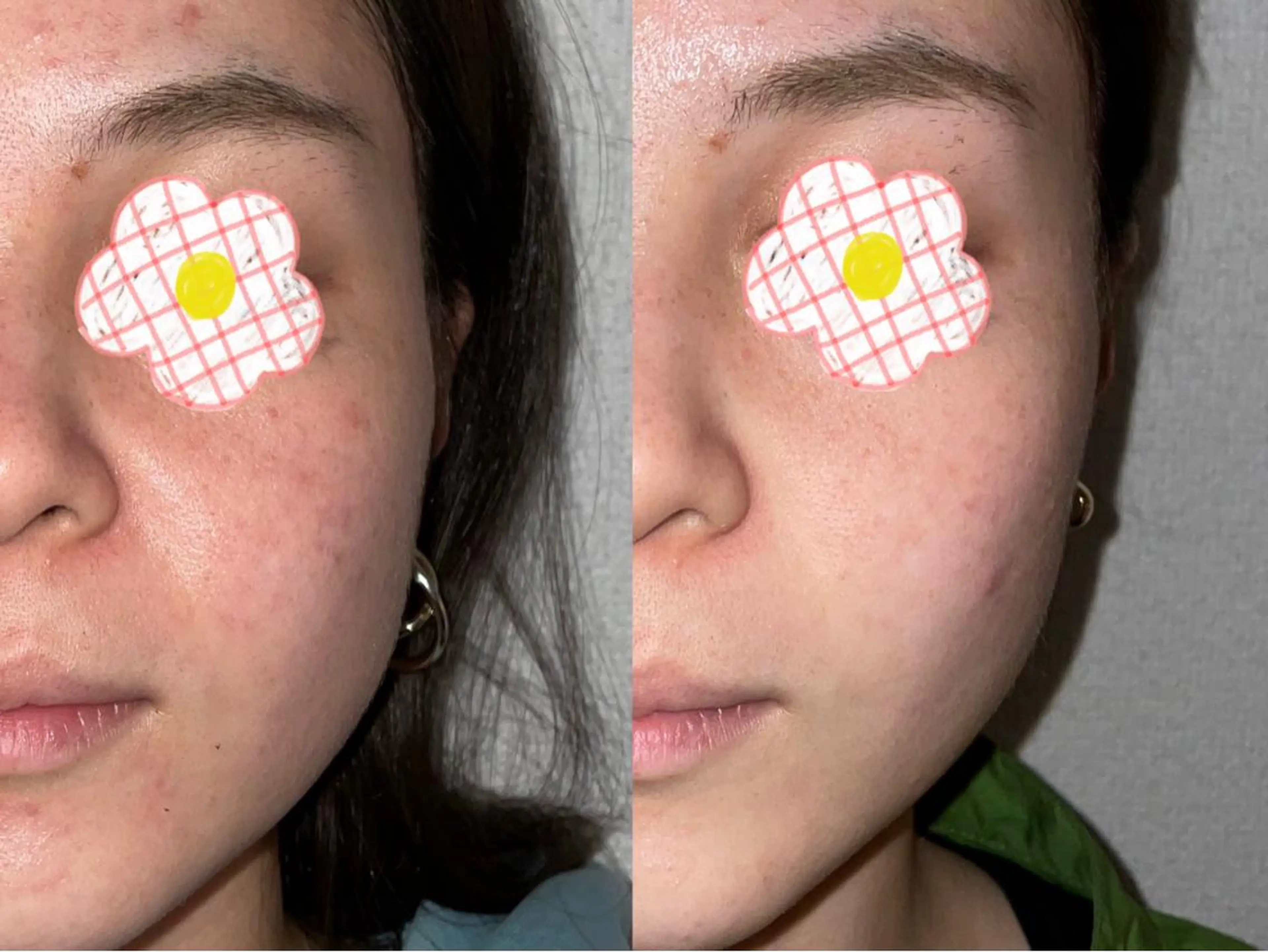 ☆専門店にお任せ☆ ホワイトニング吉祥寺のその他イメージ